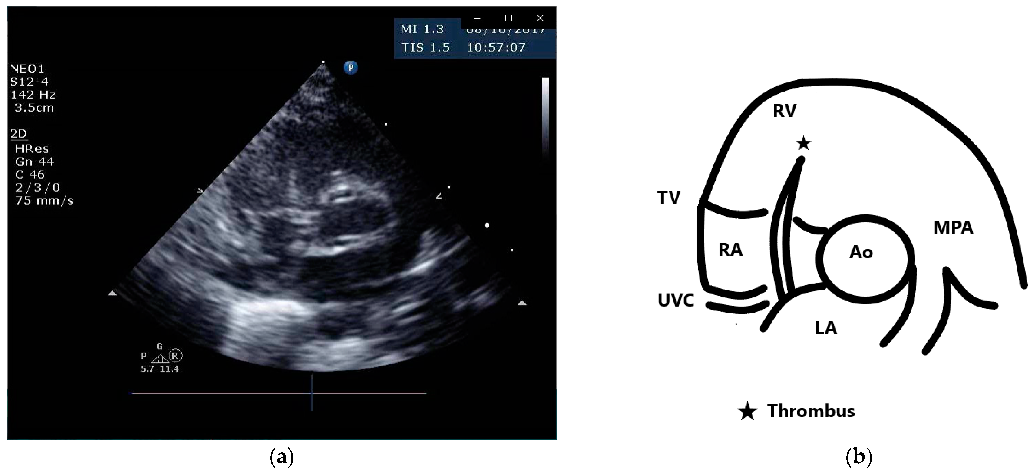Diagnostics 13 00764 g001 Diagnostics 13 00764 g001