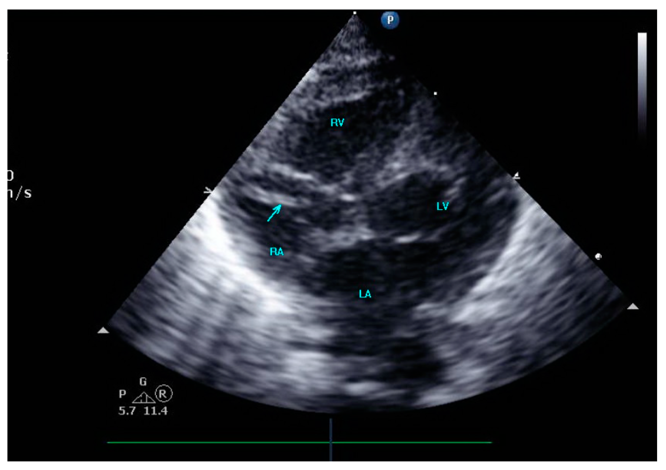 Diagnostics 13 00764 g002 Diagnostics 13 00764 g002
