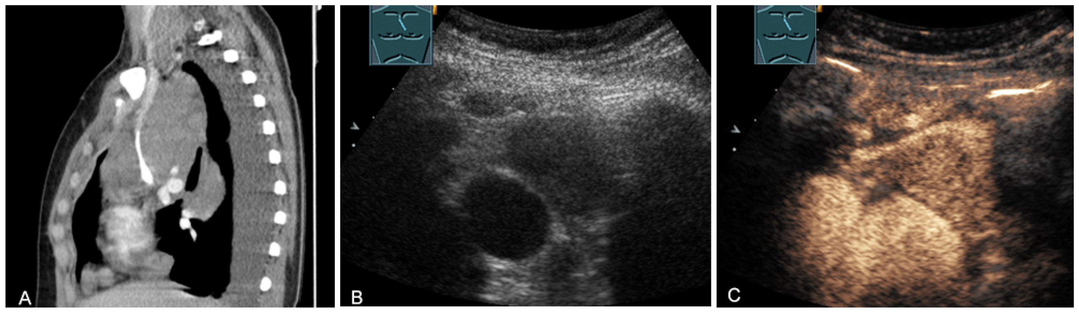 Diagnostics 13 00767 g021 Diagnostics 13 00767 g021