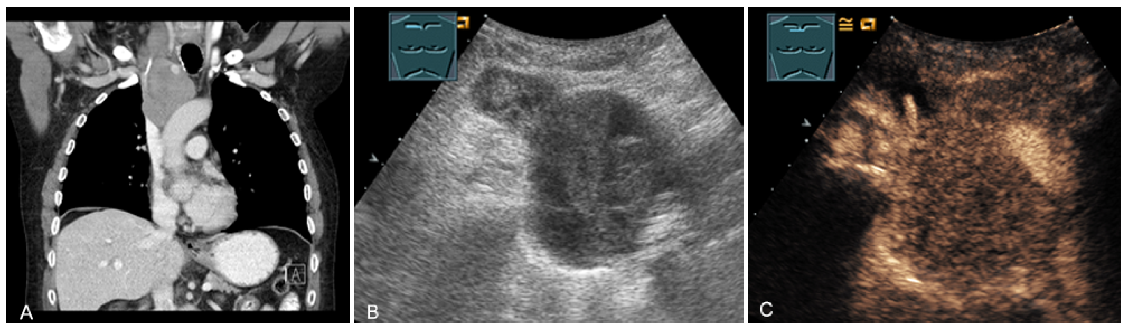 Diagnostics 13 00767 g022 Diagnostics 13 00767 g022