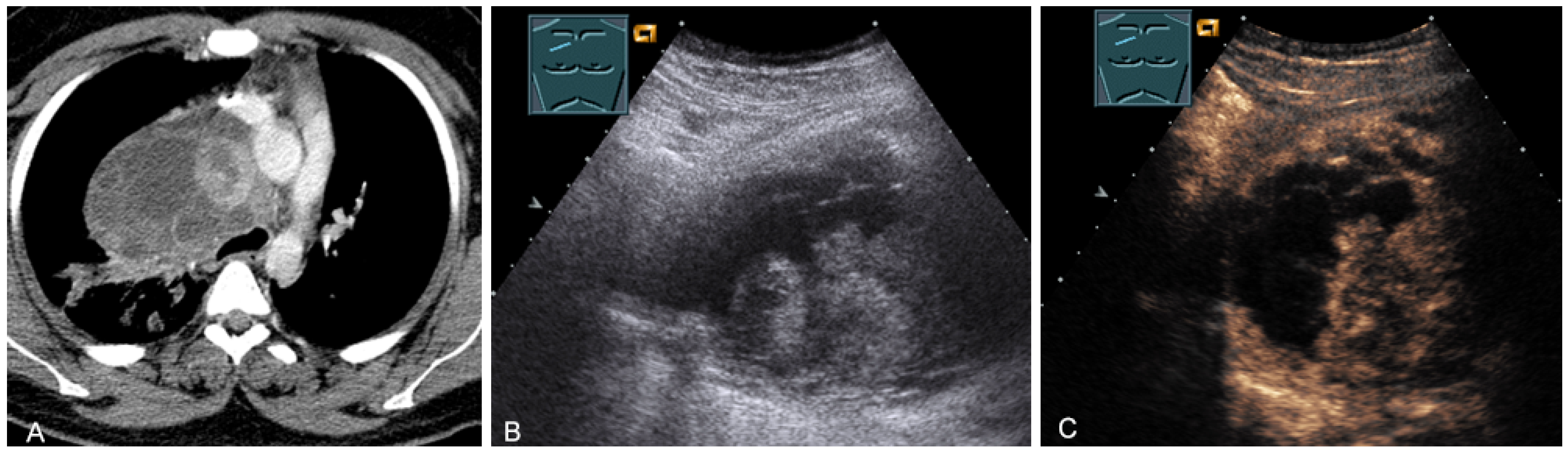 Diagnostics 13 00767 g023 Diagnostics 13 00767 g023