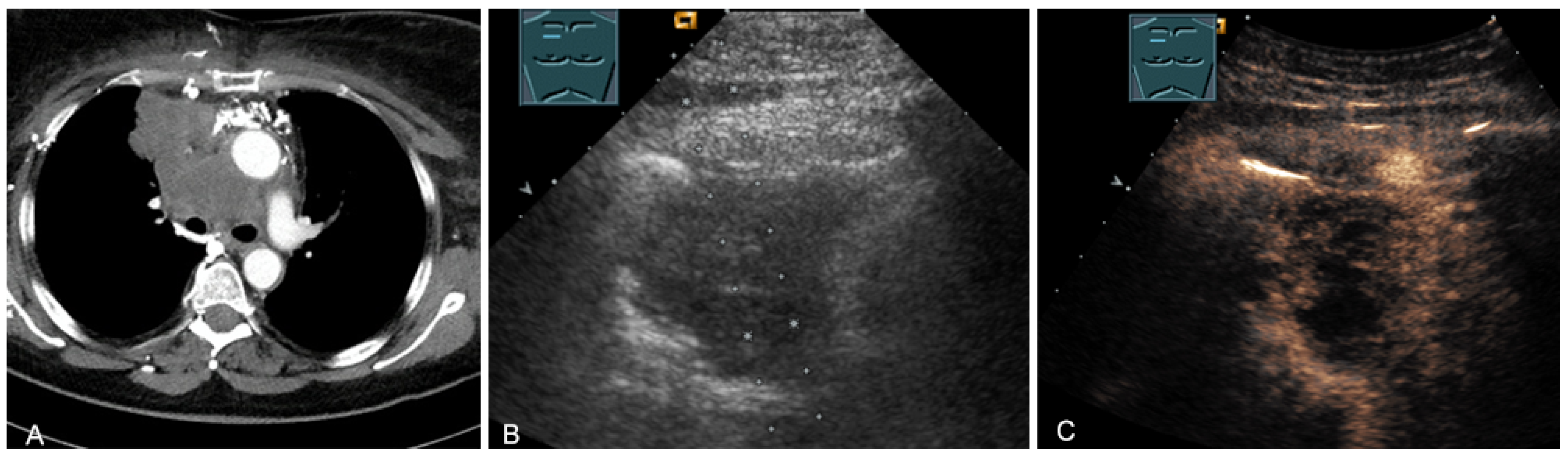 Diagnostics 13 00767 g024 Diagnostics 13 00767 g024