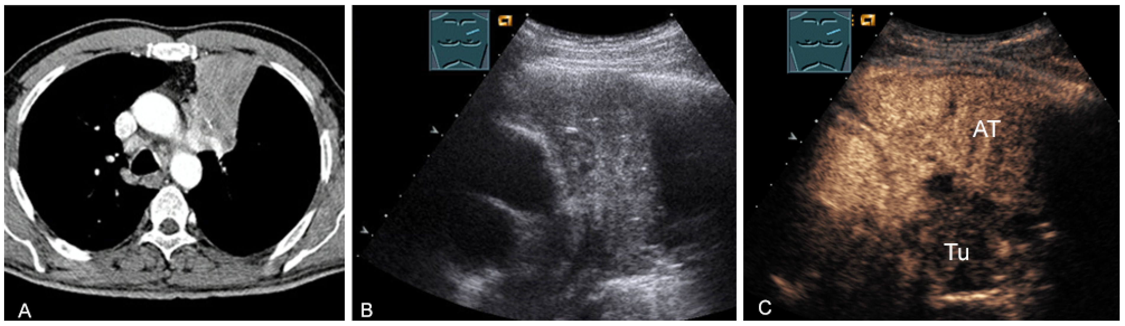Diagnostics 13 00767 g025 Diagnostics 13 00767 g025