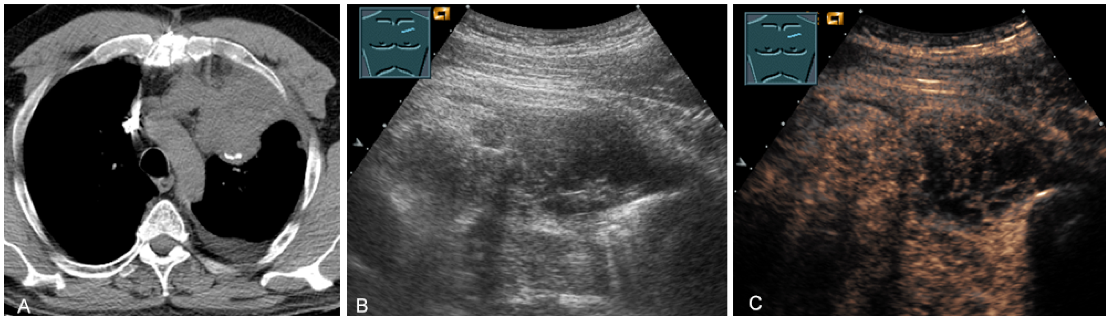 Diagnostics 13 00767 g026 Diagnostics 13 00767 g026
