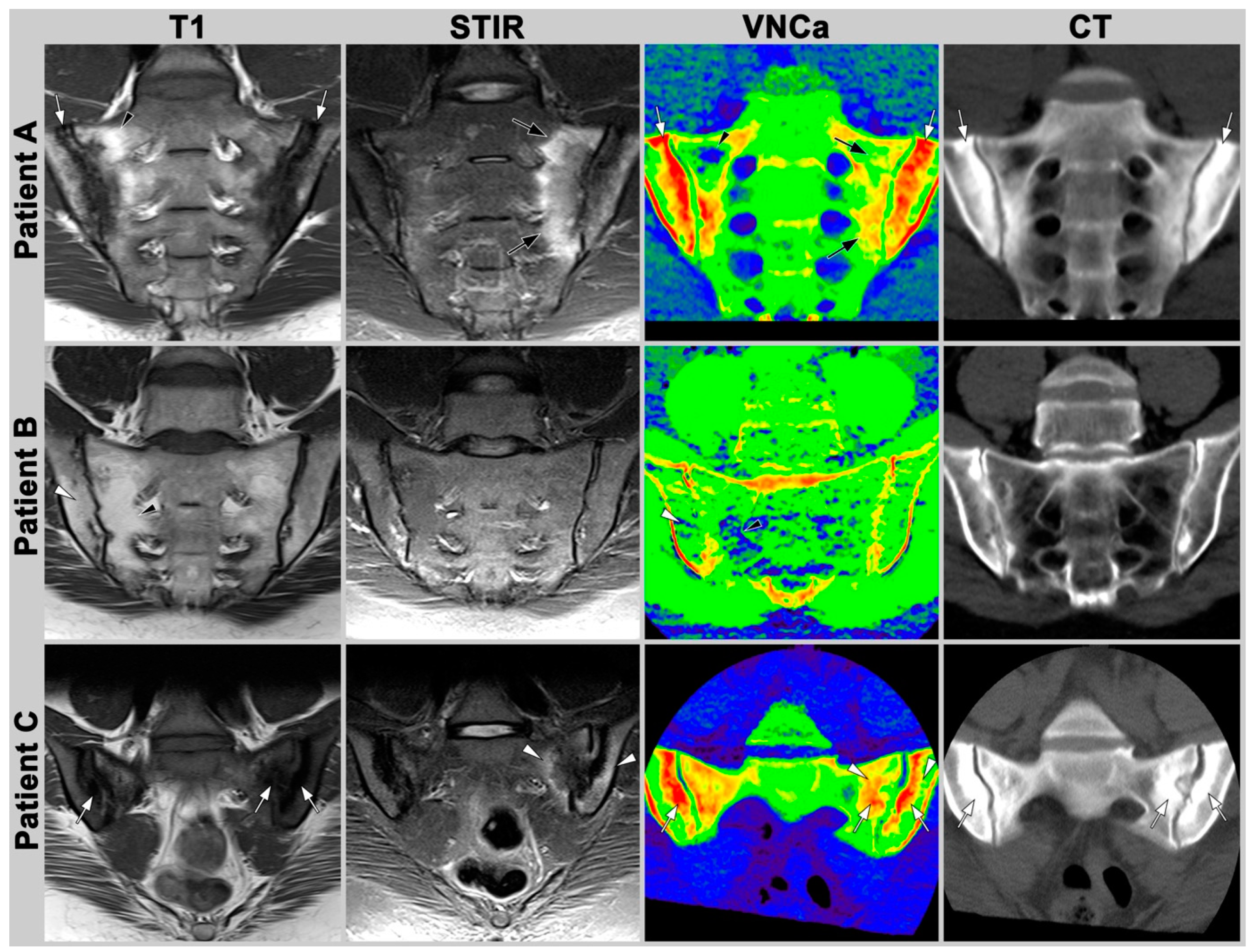 Diagnostics 13 00776 g002 Diagnostics 13 00776 g002