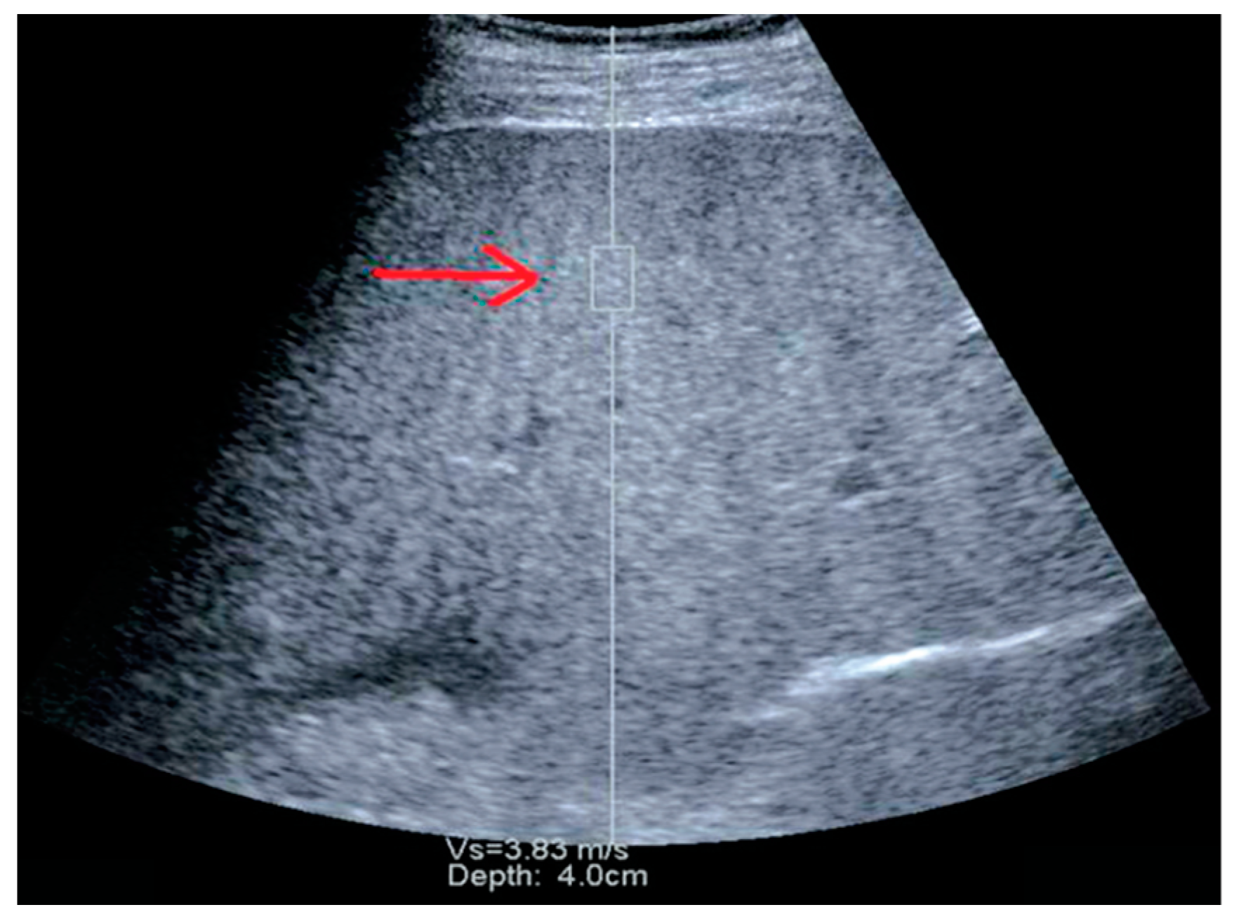 Diagnostics 13 00788 g002 Diagnostics 13 00788 g002