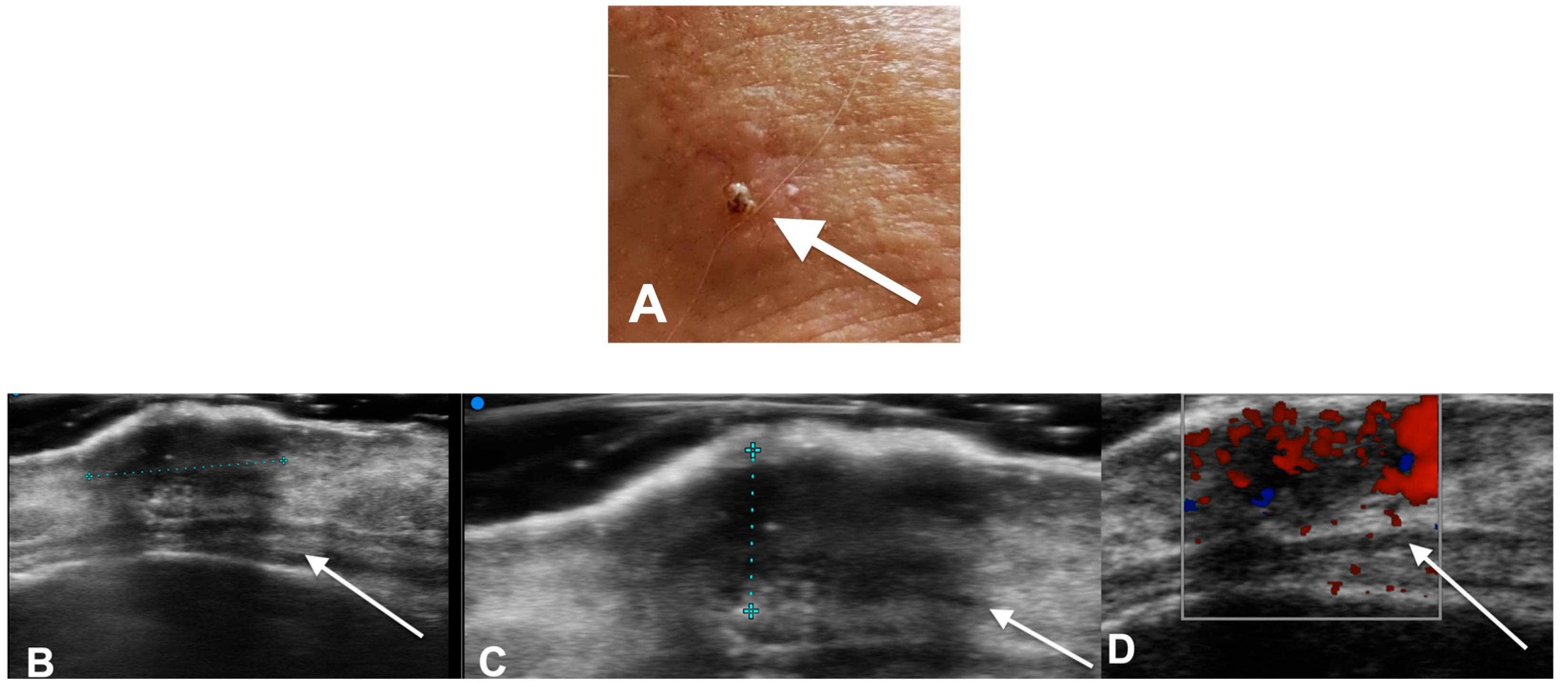 Diagnostics 13 00793 g001
