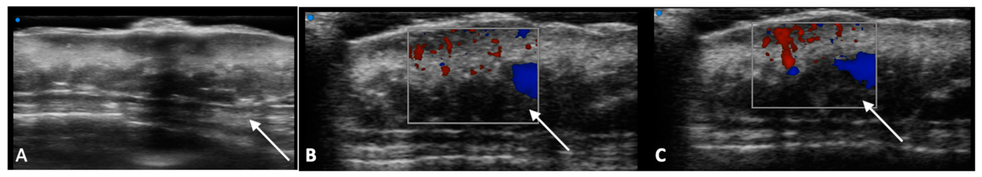 Diagnostics 13 00793 g002