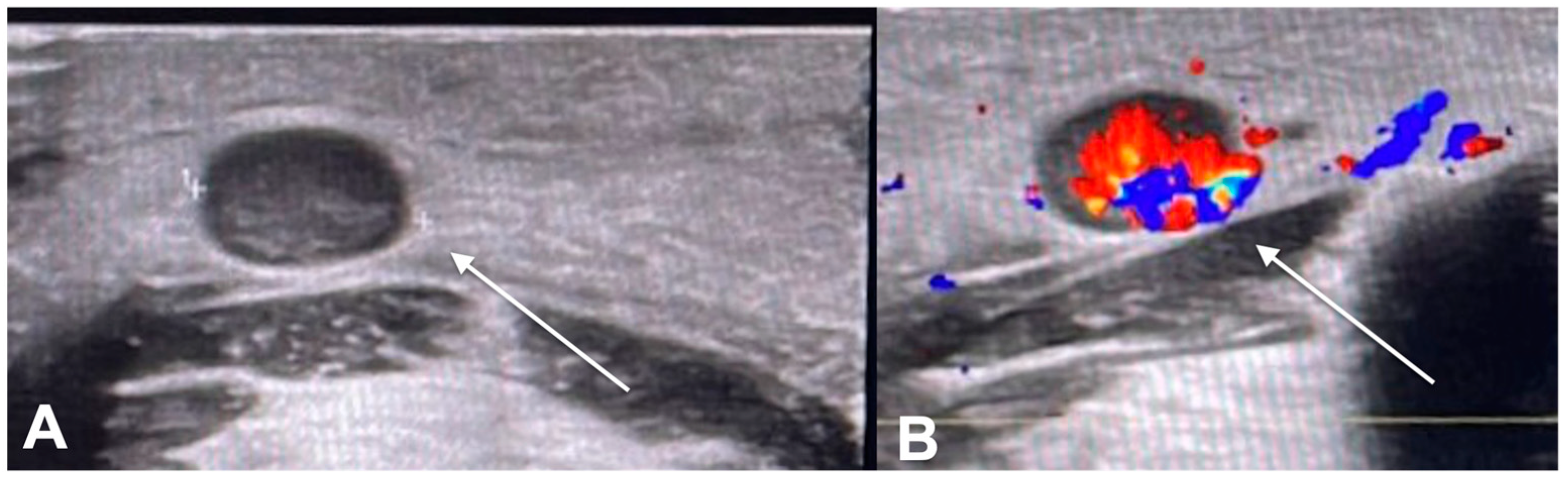 Diagnostics 13 00793 g003
