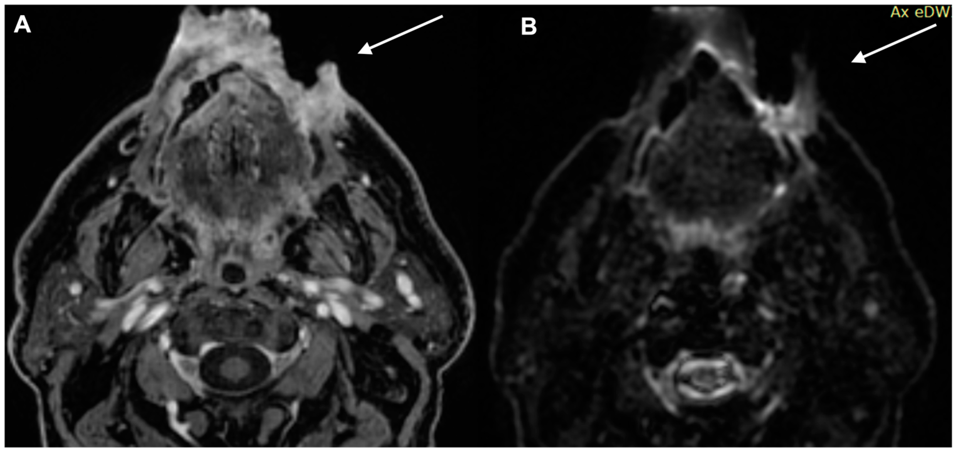Diagnostics 13 00793 g005