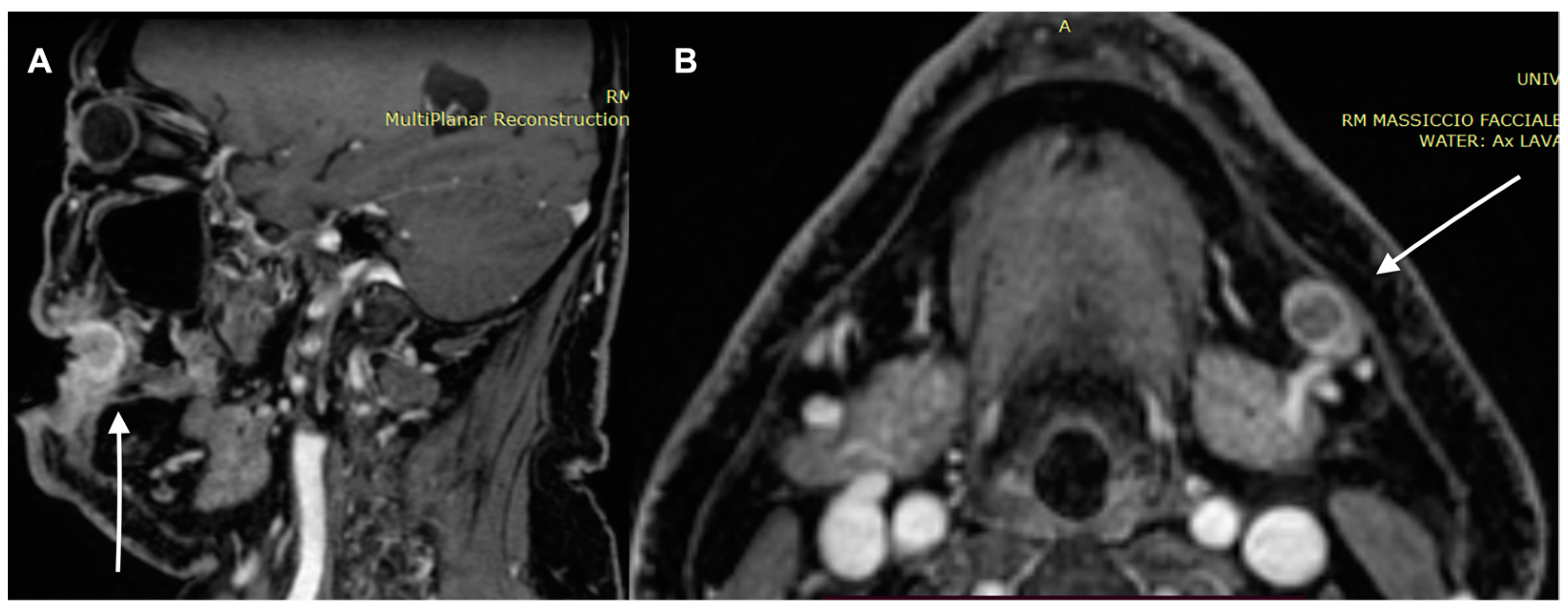 Diagnostics 13 00793 g006