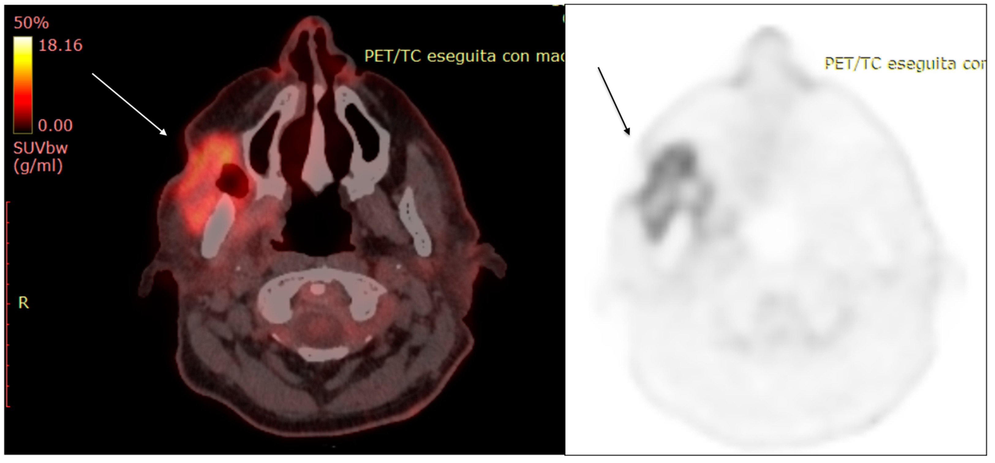 Diagnostics 13 00793 g008