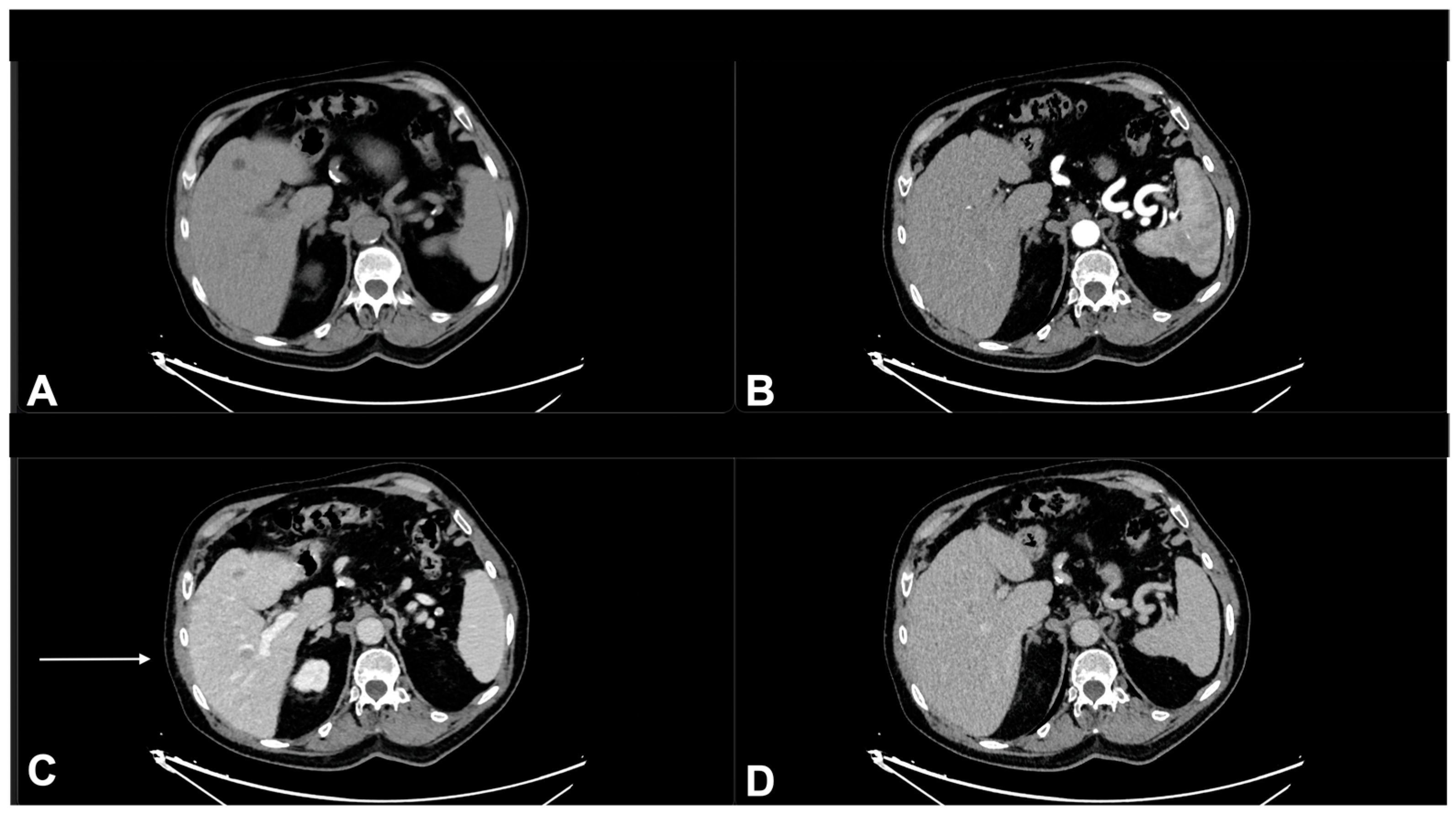 Diagnostics 13 00793 g009
