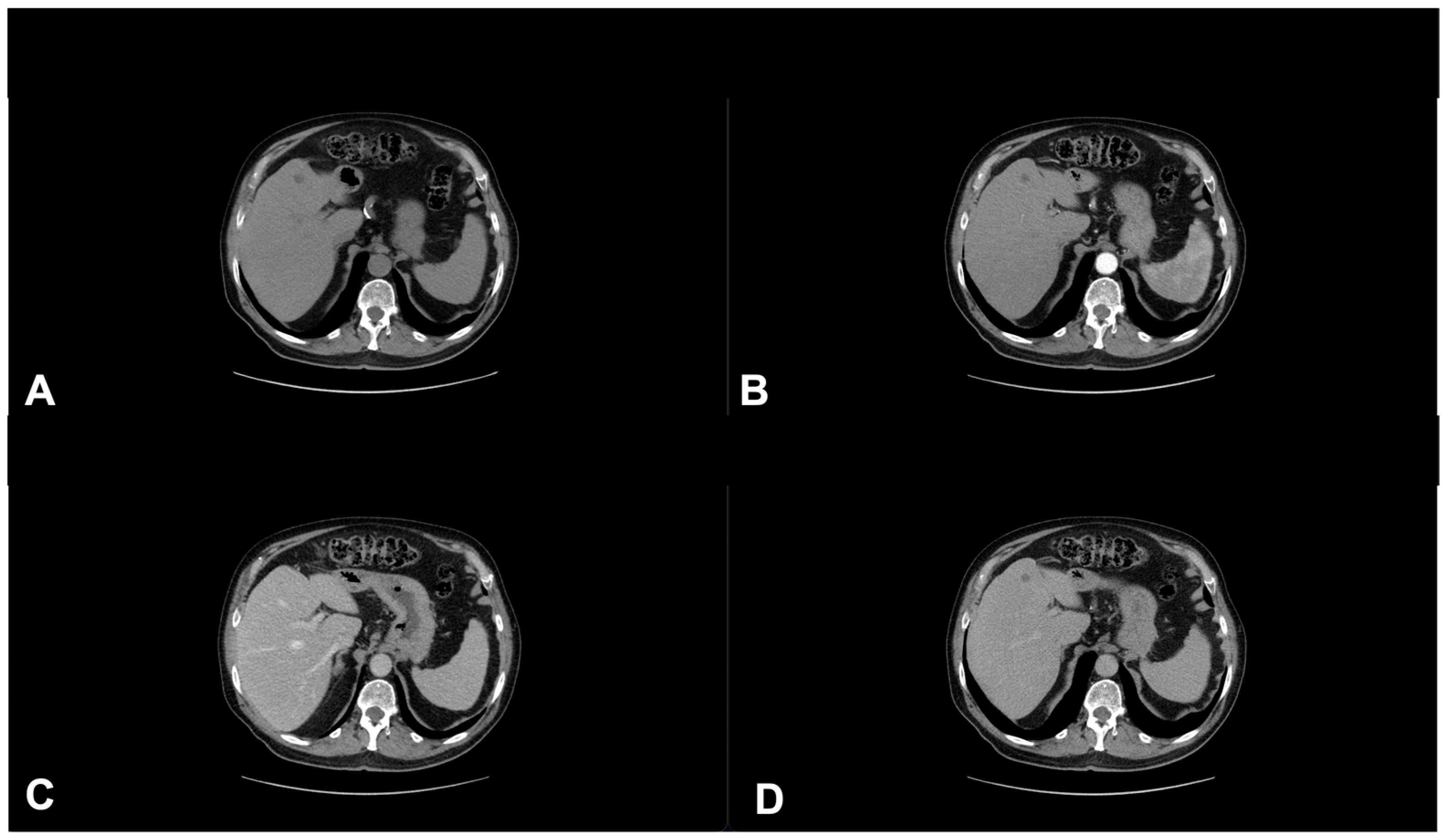 Diagnostics 13 00793 g012