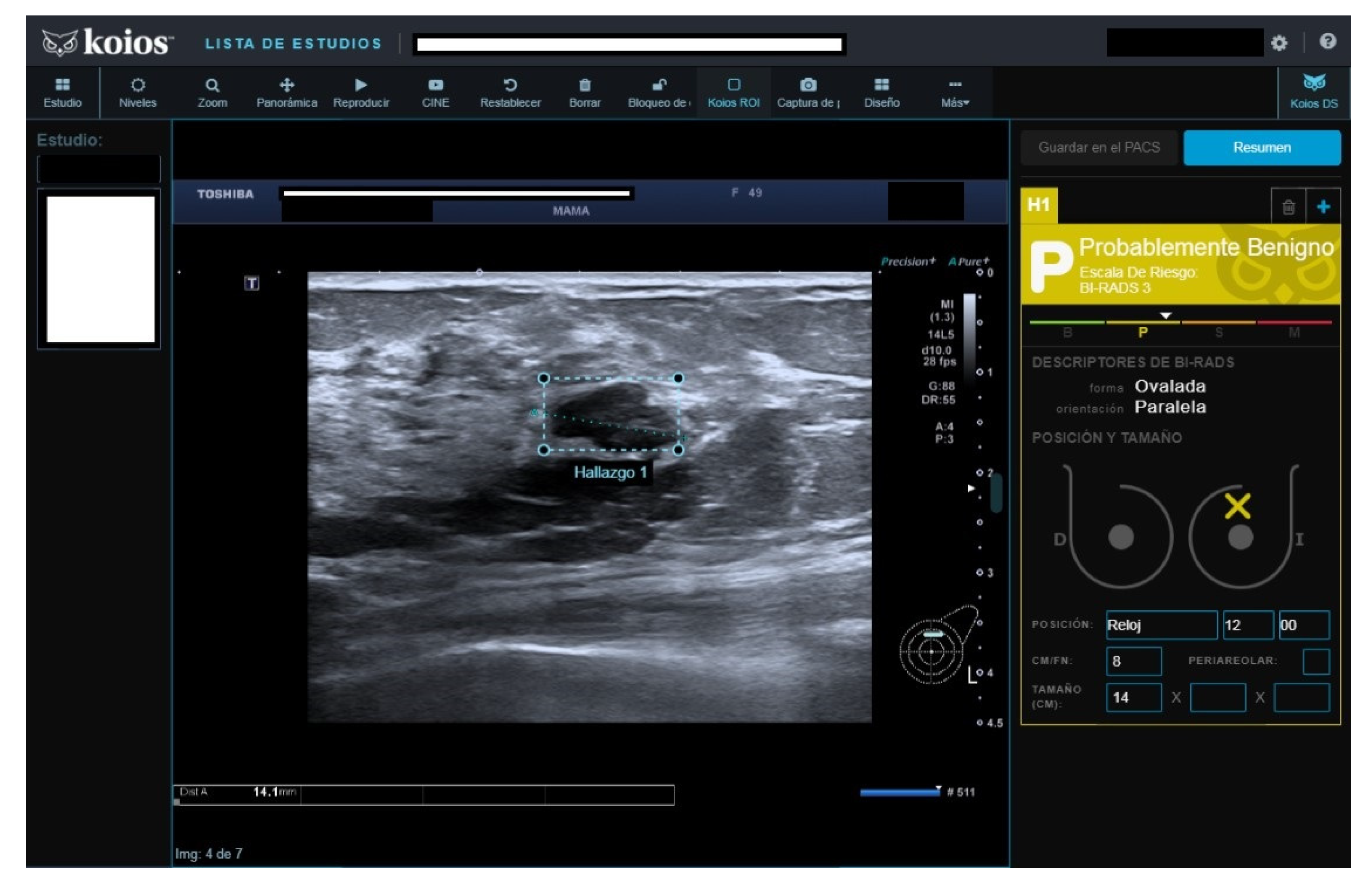 Diagnostics 13 00811 g003