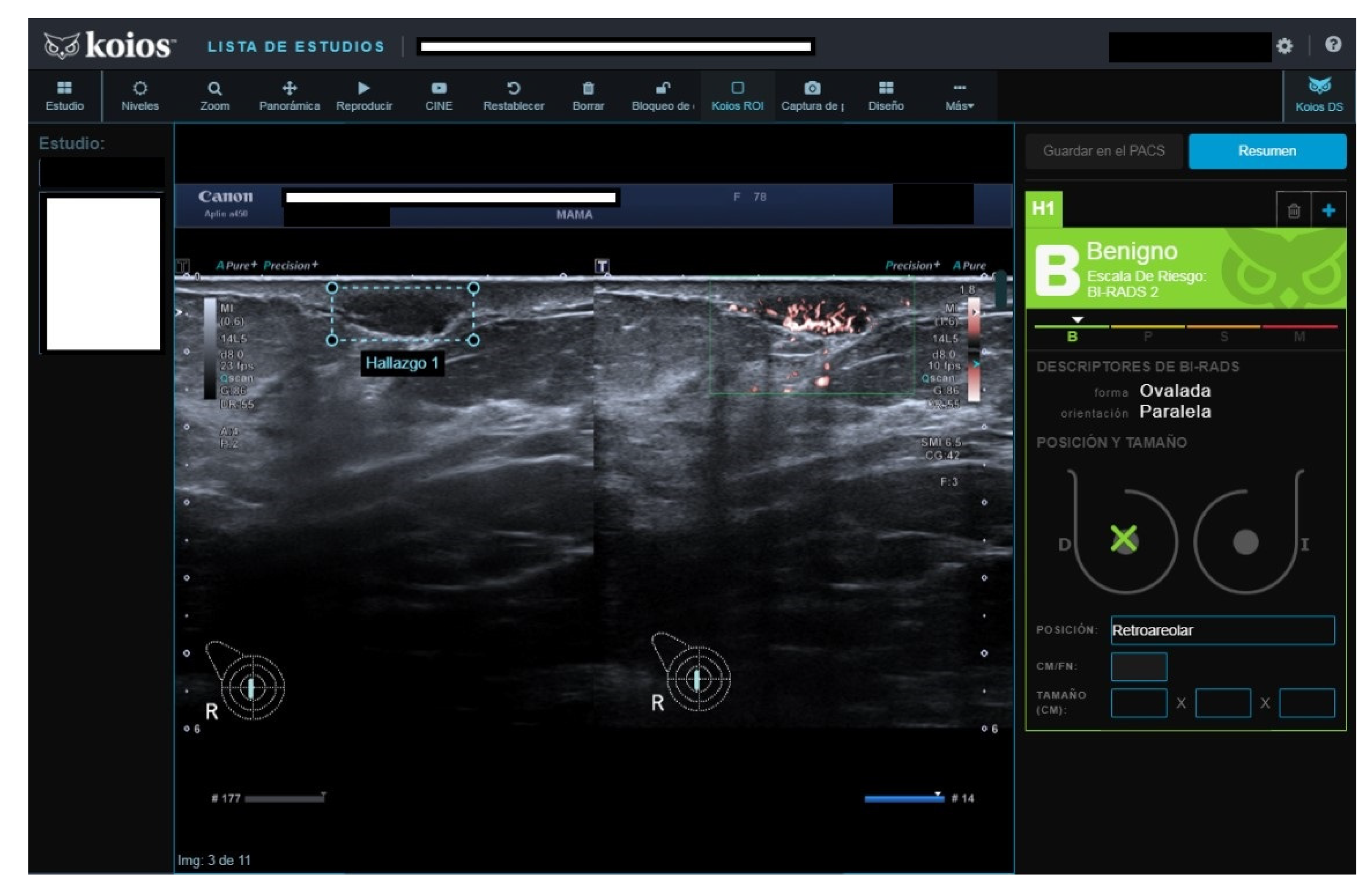 Diagnostics 13 00811 g005