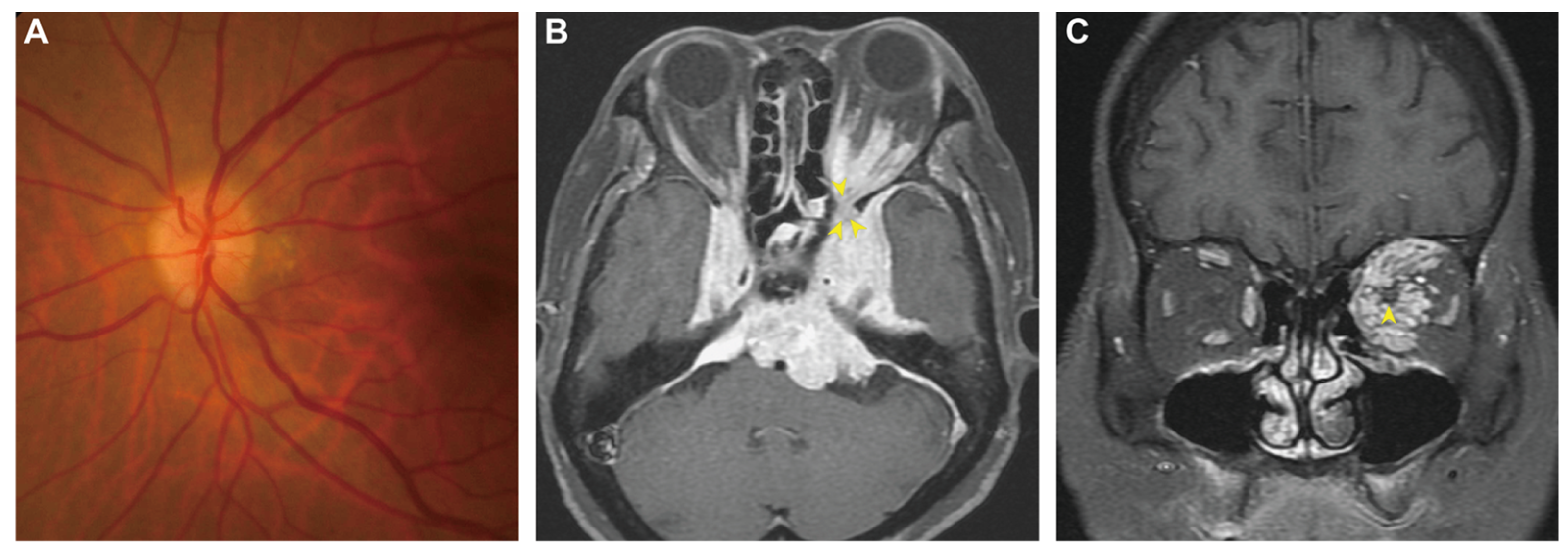 Diagnostics 13 00815 g001