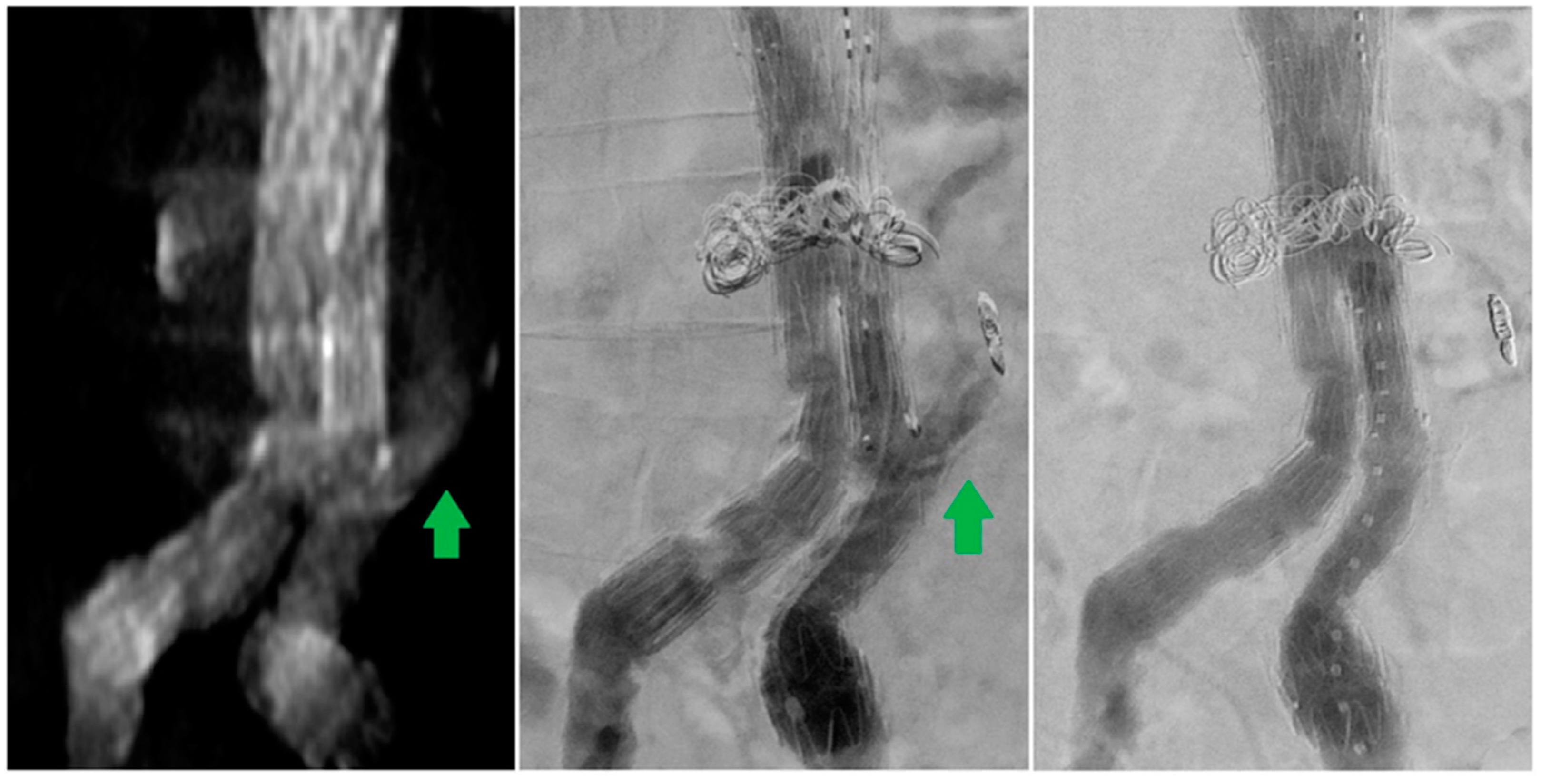 Diagnostics Free FullText Dynamic Computed Tomography Angiography