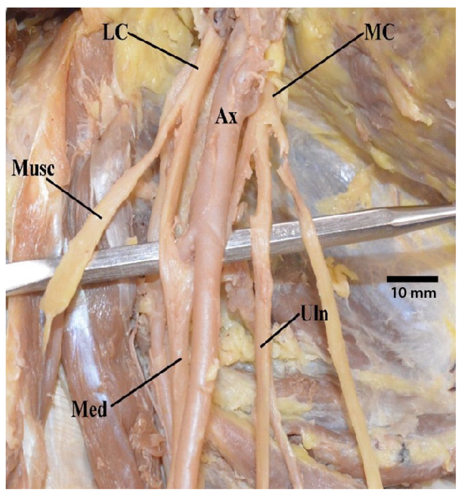 Diagnostics 13 00830 g001