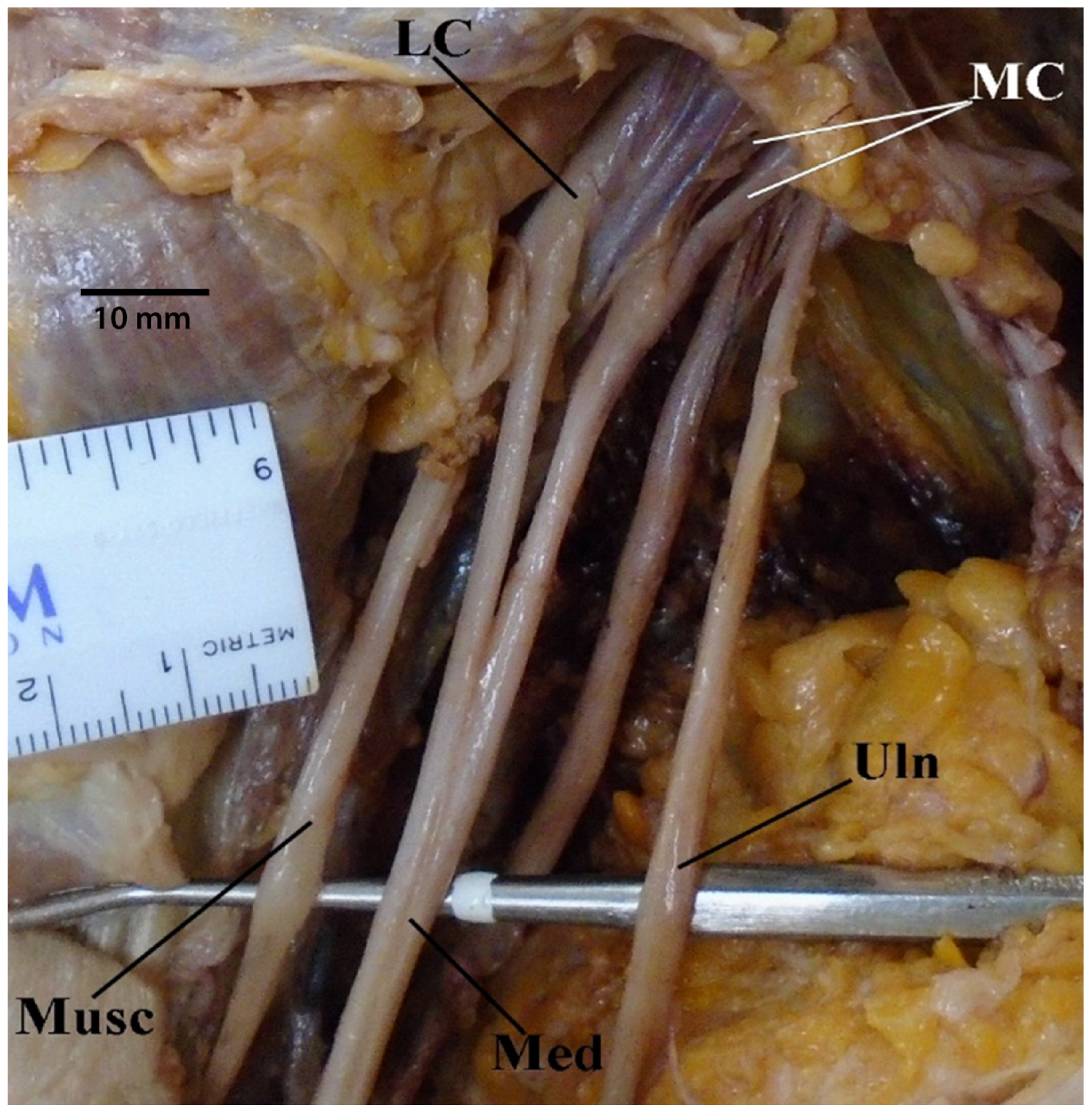 Diagnostics 13 00830 g003