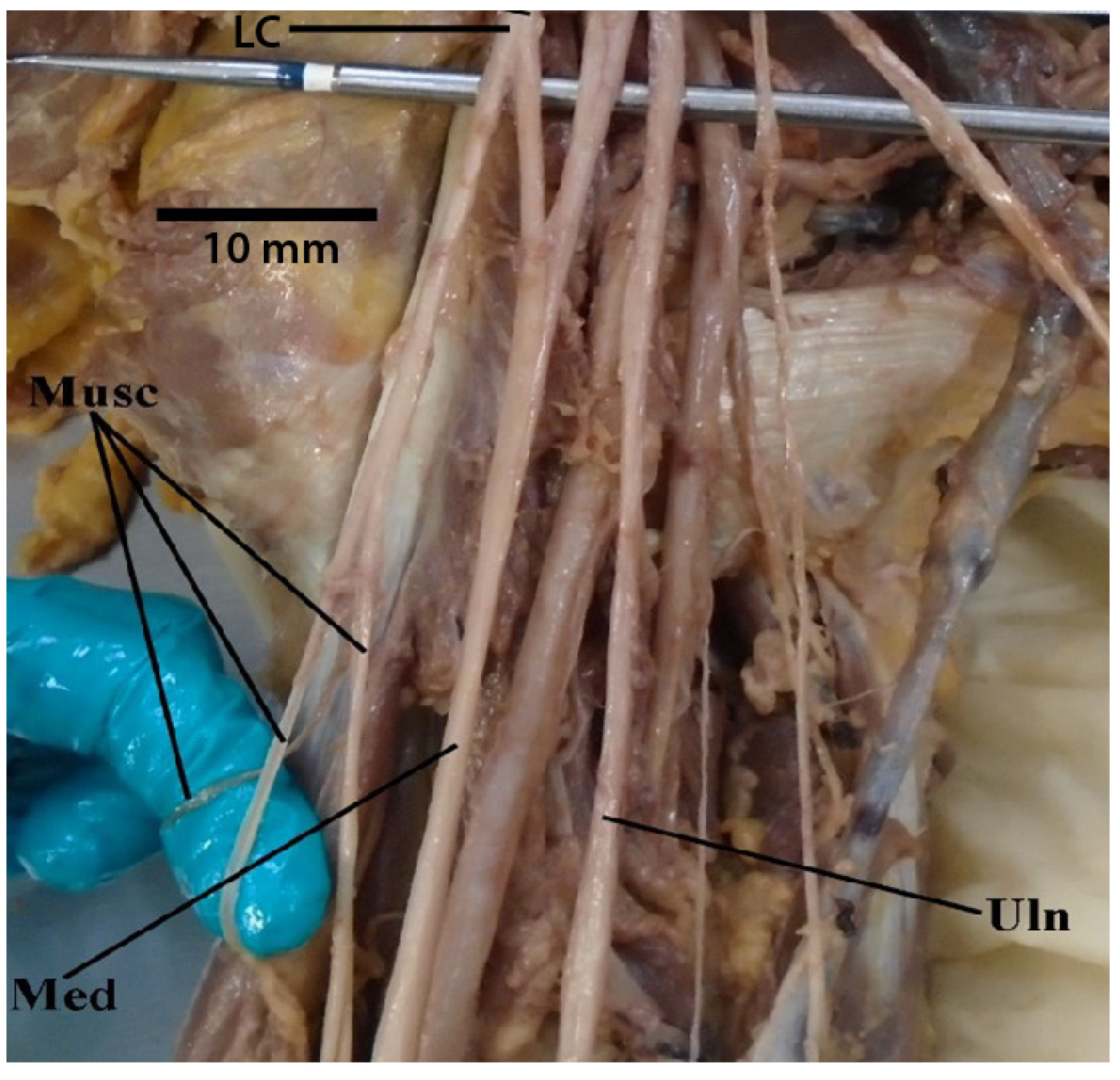 Diagnostics 13 00830 g005