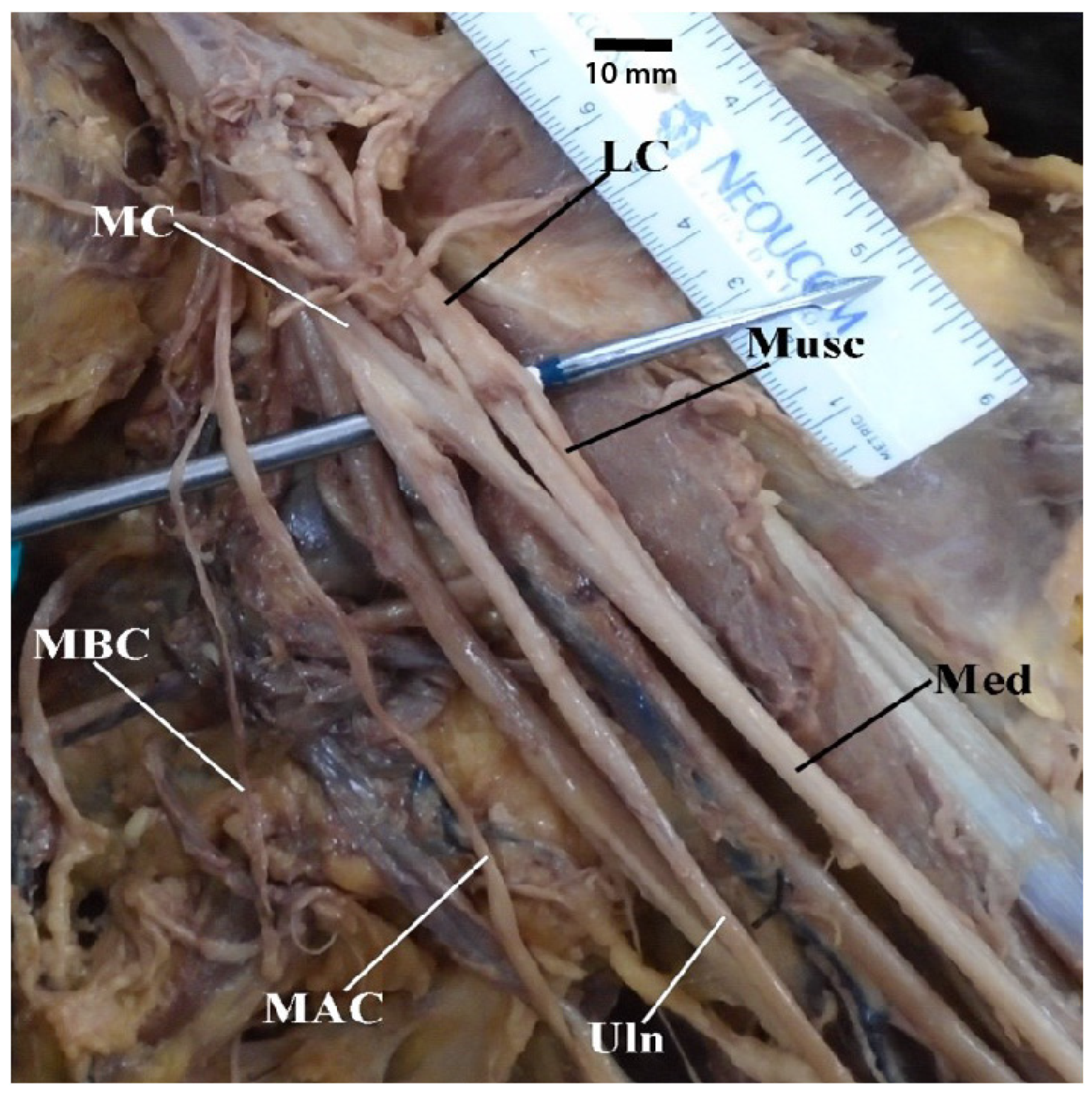 Diagnostics 13 00830 g006