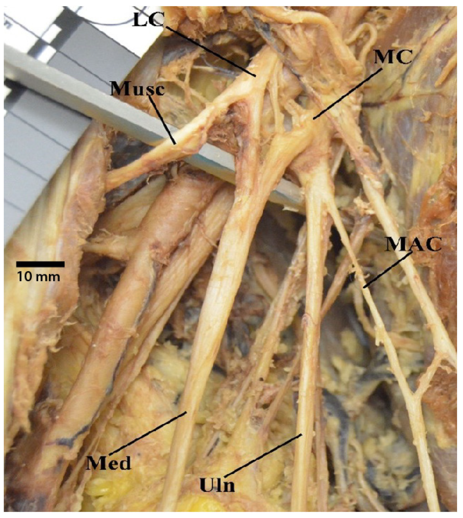 Diagnostics 13 00830 g008