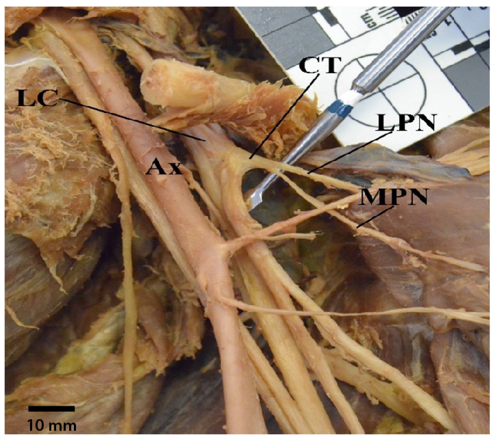 Diagnostics 13 00830 g010