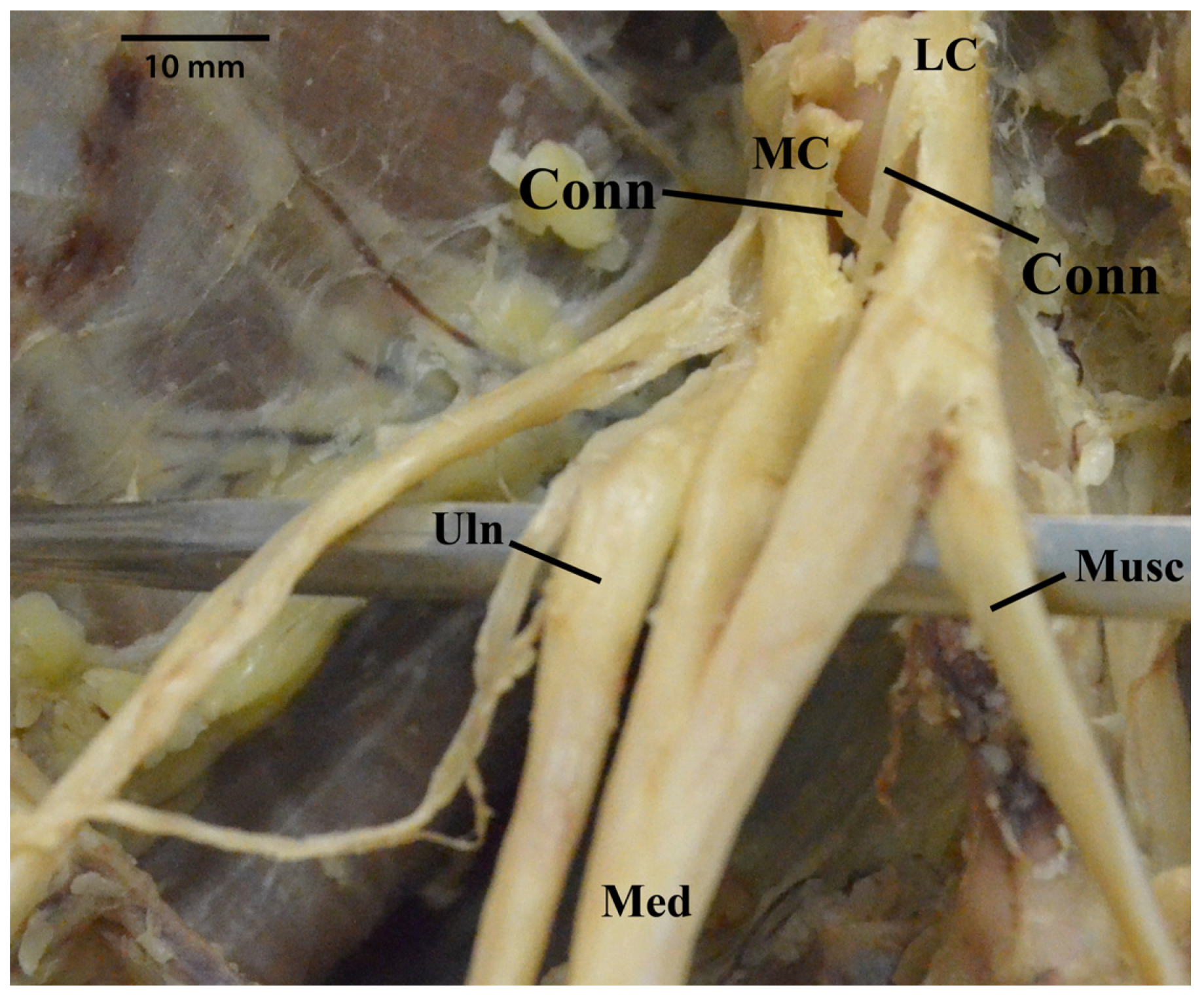 Diagnostics 13 00830 g012