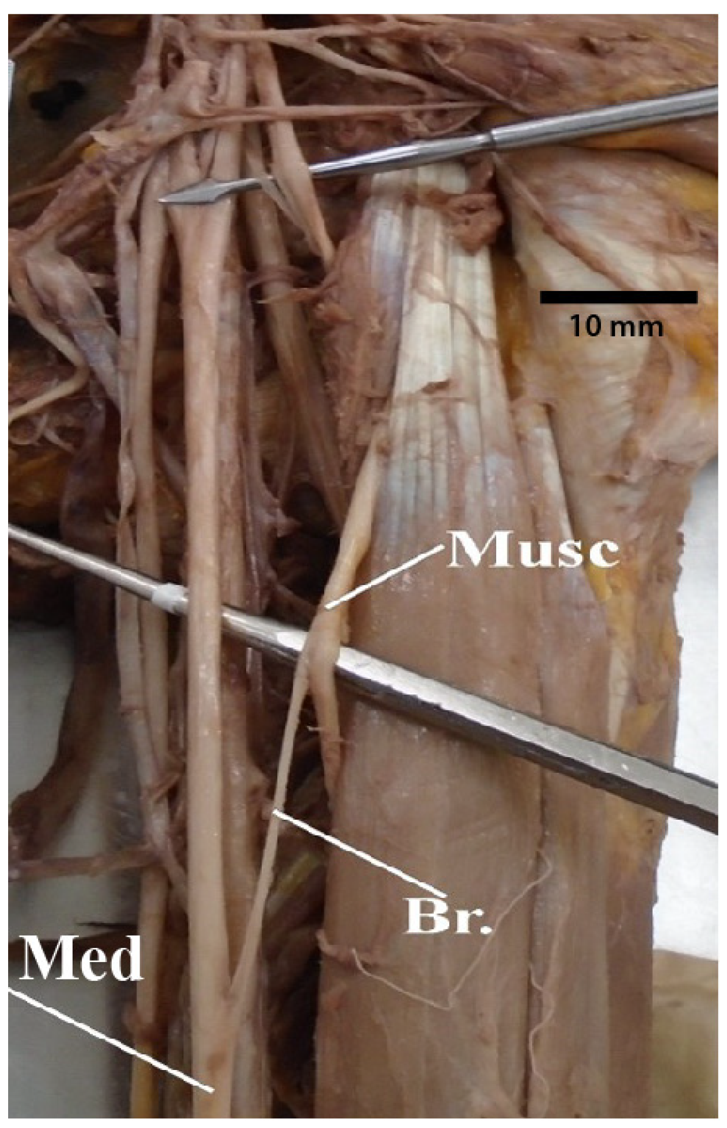 Diagnostics 13 00830 g013