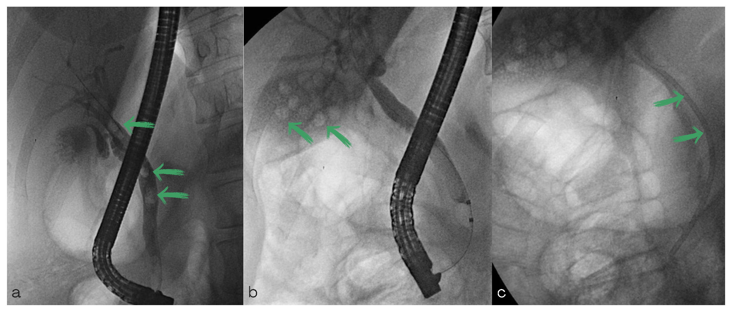 Diagnostics 13 00831 g001