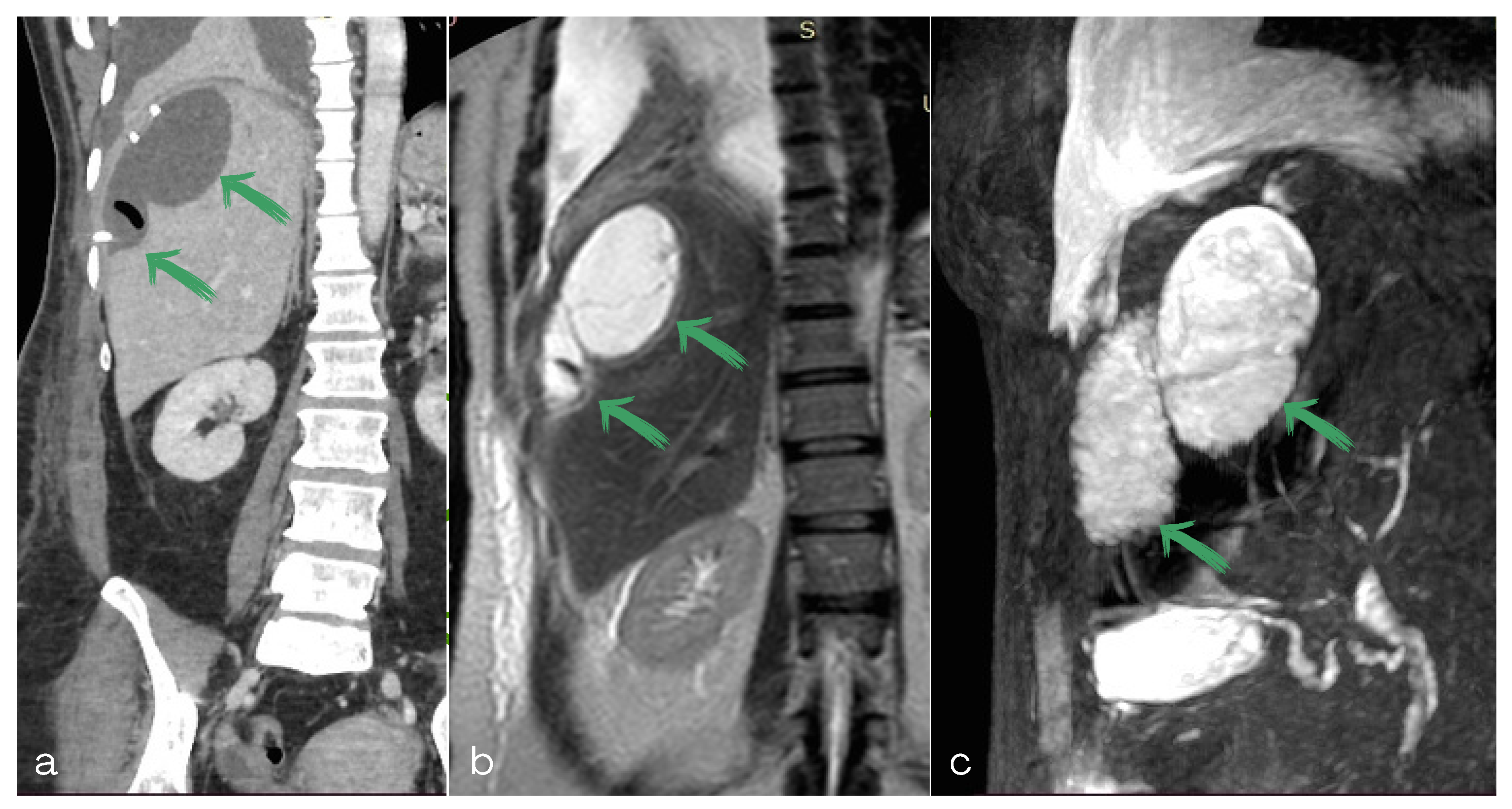 Diagnostics 13 00831 g004