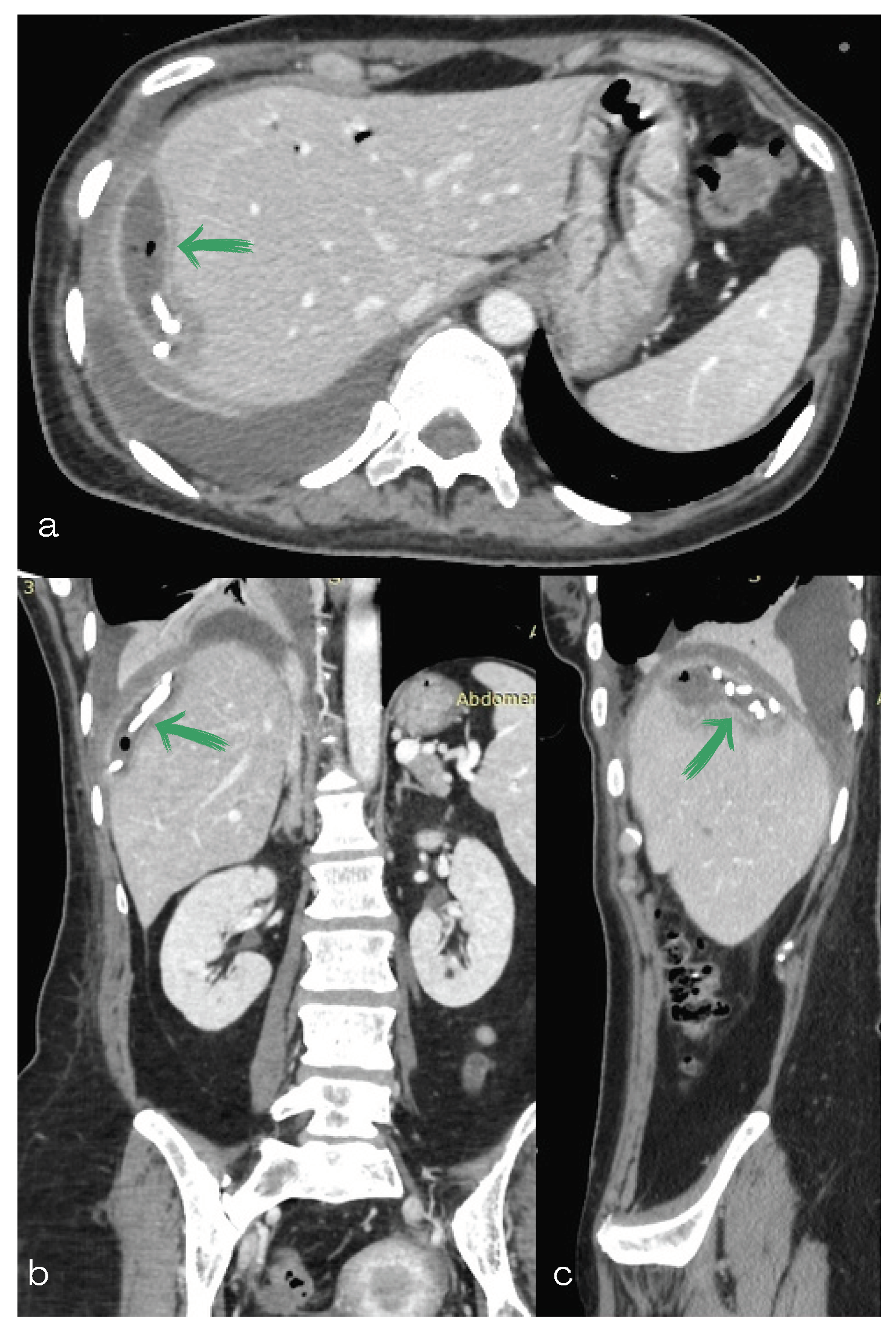 Diagnostics 13 00831 g006