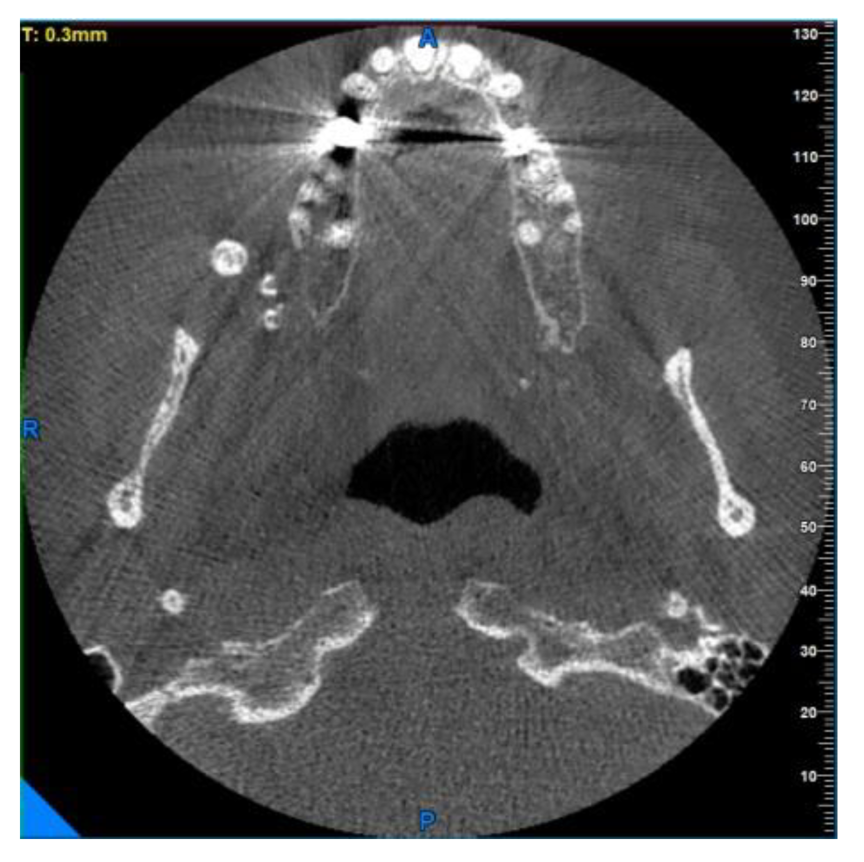 Diagnostics 13 00840 g007 Diagnostics 13 00840 g007