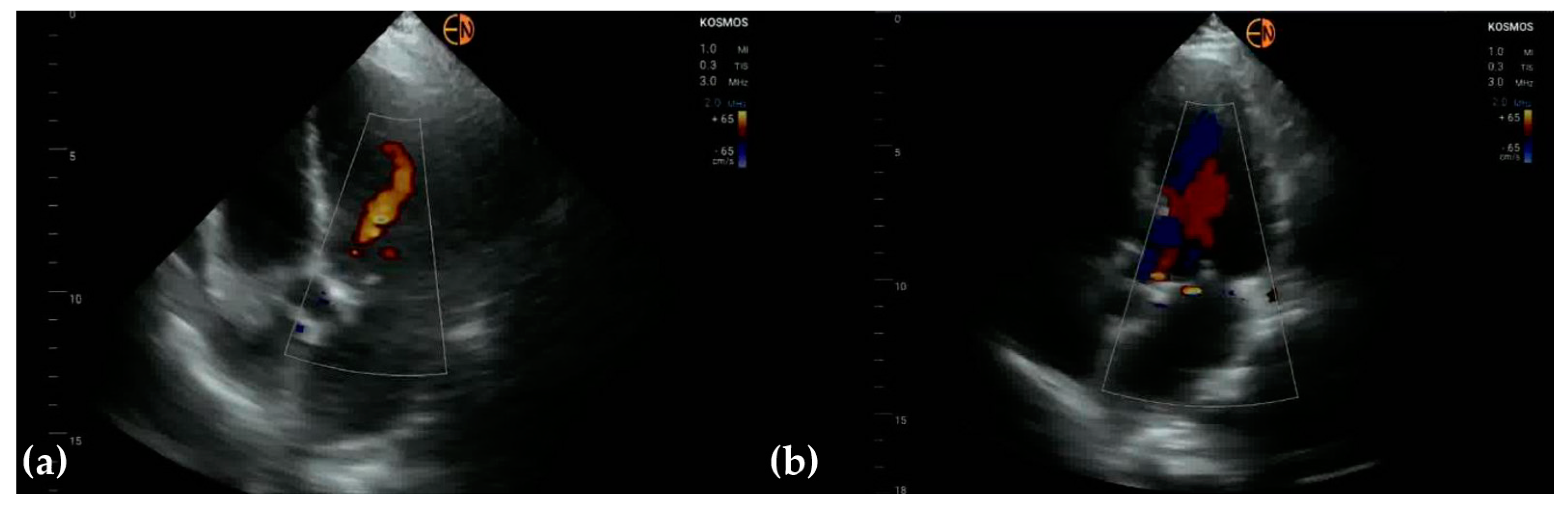 Diagnostics 13 00853 g003 Diagnostics 13 00853 g003