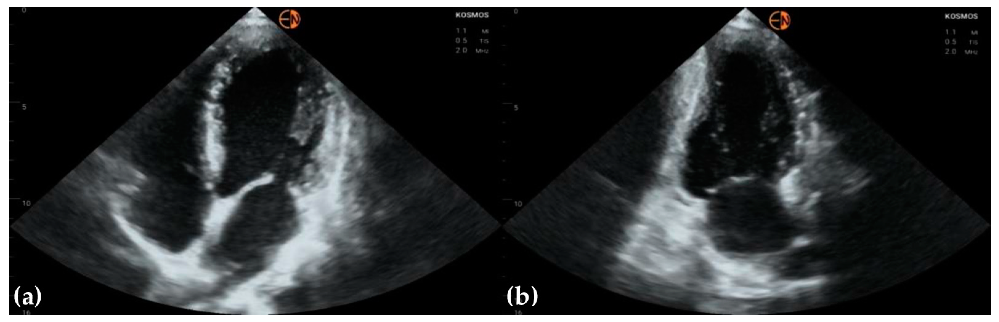Diagnostics 13 00853 g004 Diagnostics 13 00853 g004