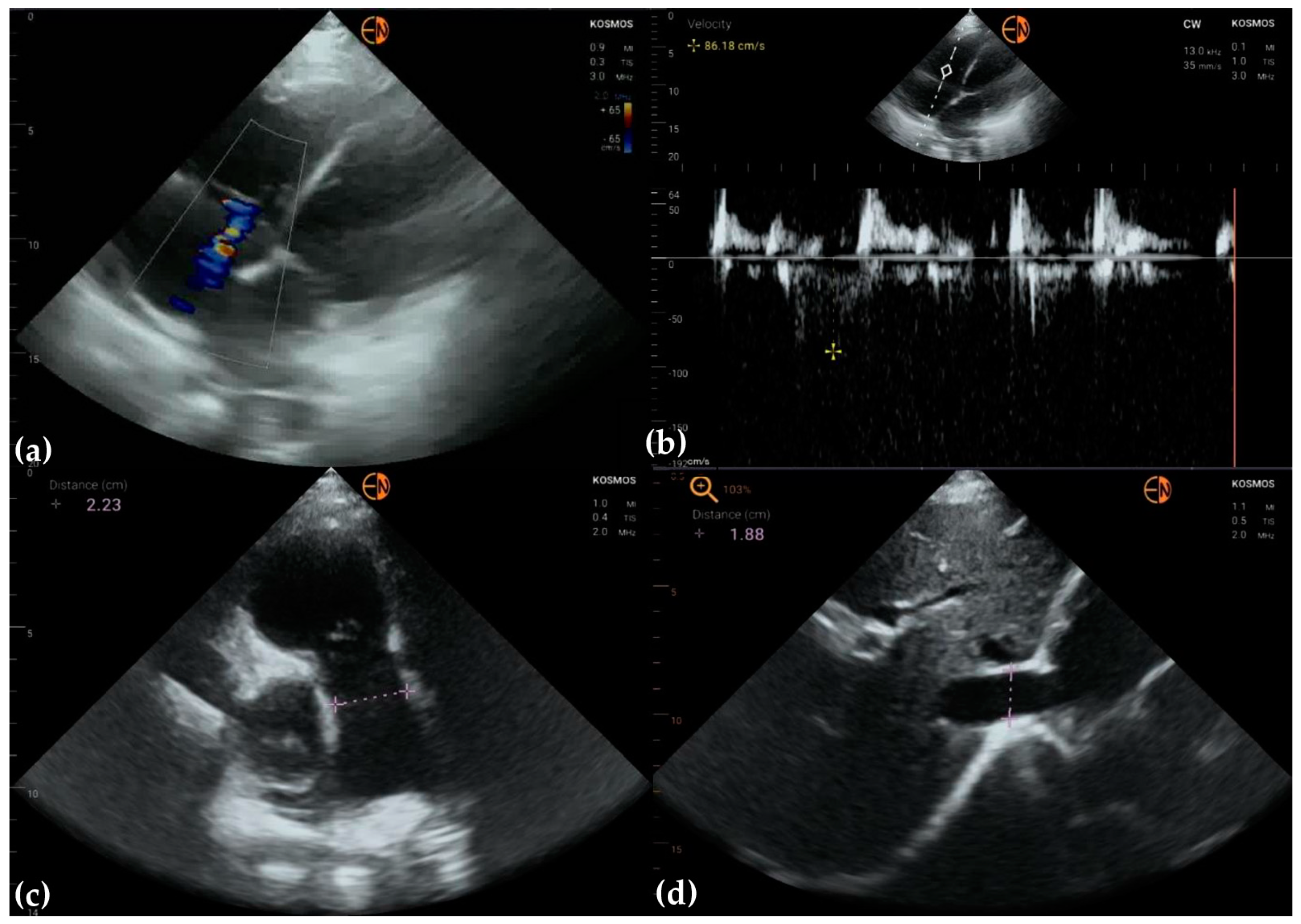Diagnostics 13 00853 g005 Diagnostics 13 00853 g005