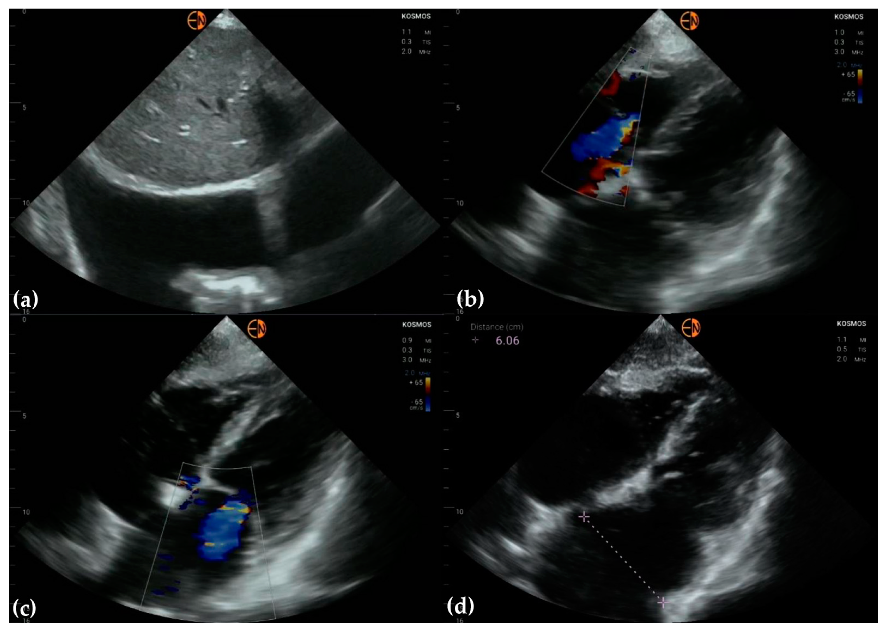 Diagnostics 13 00853 g006 Diagnostics 13 00853 g006