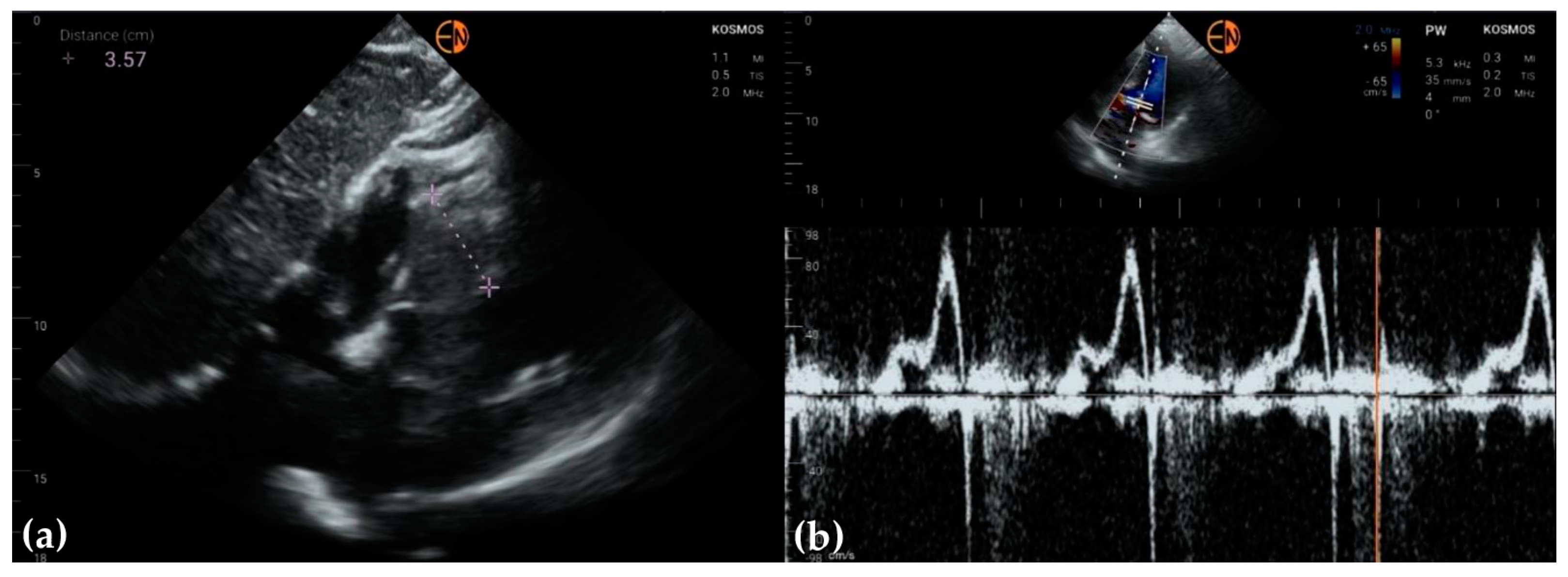 Diagnostics 13 00853 g007 Diagnostics 13 00853 g007