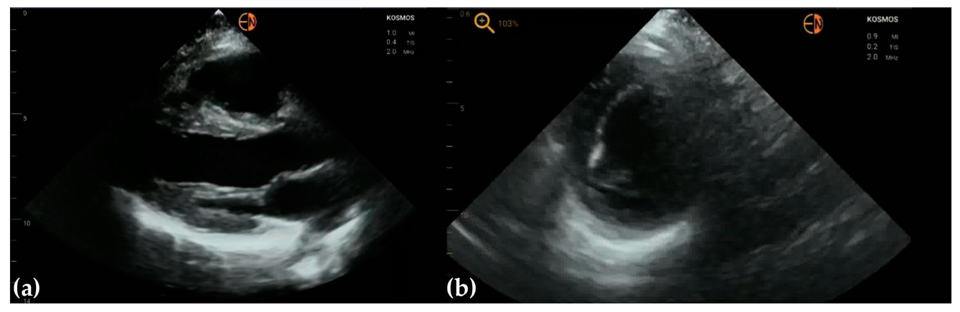 Diagnostics 13 00853 g008 Diagnostics 13 00853 g008