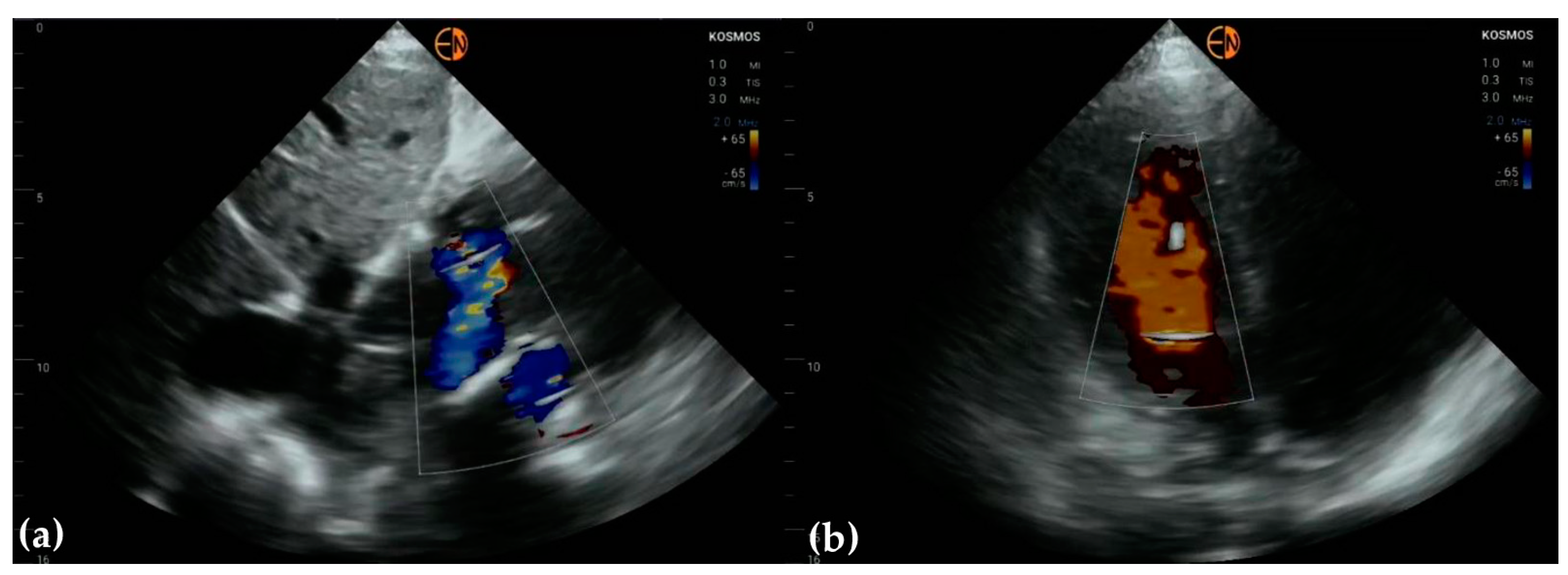 Diagnostics 13 00853 g009 Diagnostics 13 00853 g009