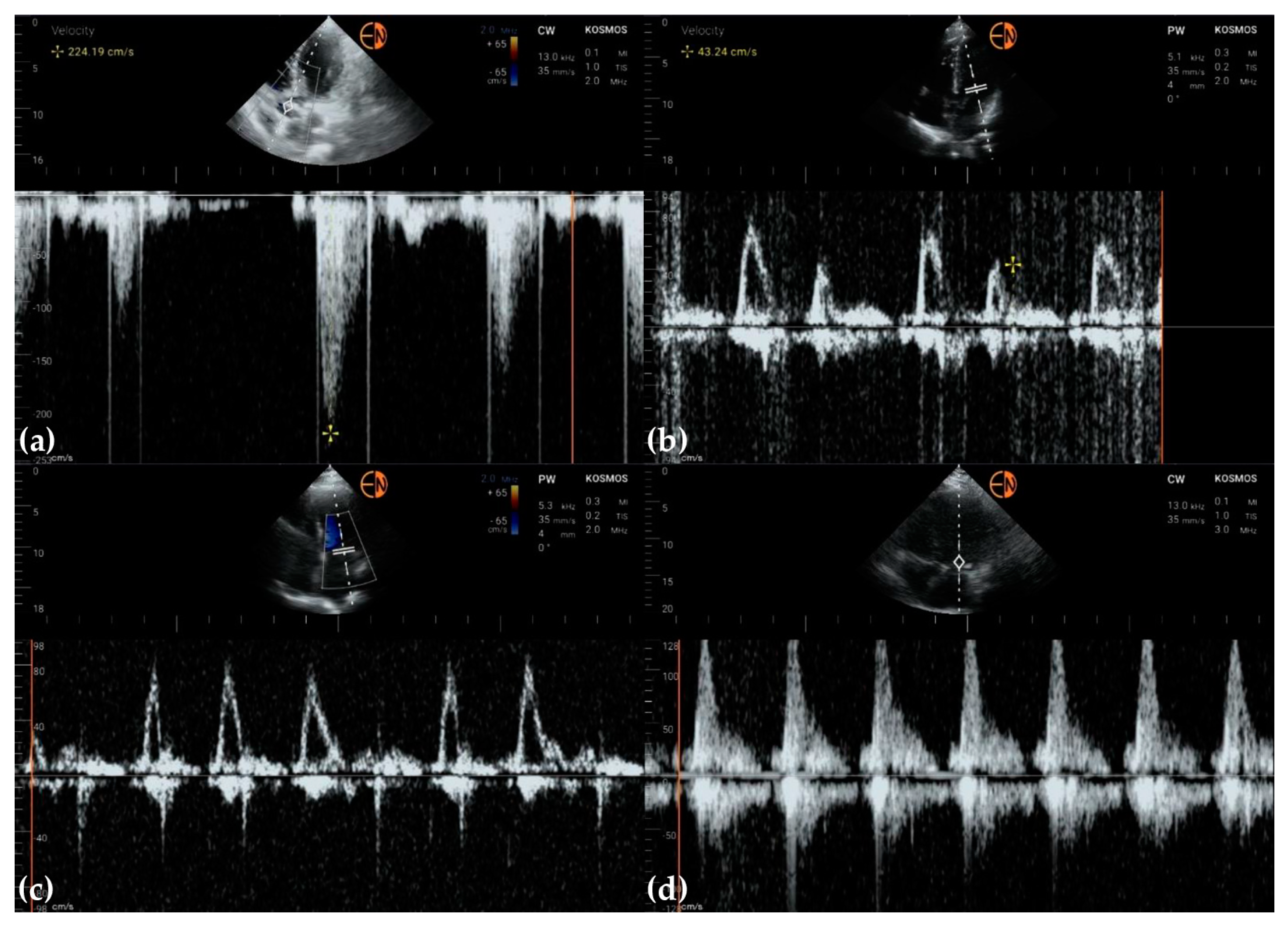 Diagnostics 13 00853 g011 Diagnostics 13 00853 g011