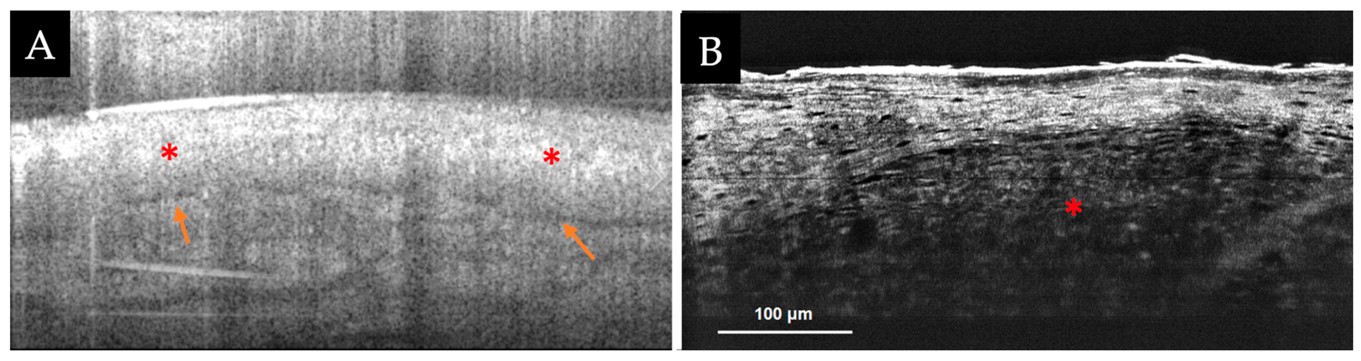 Diagnostics 13 00854 g003