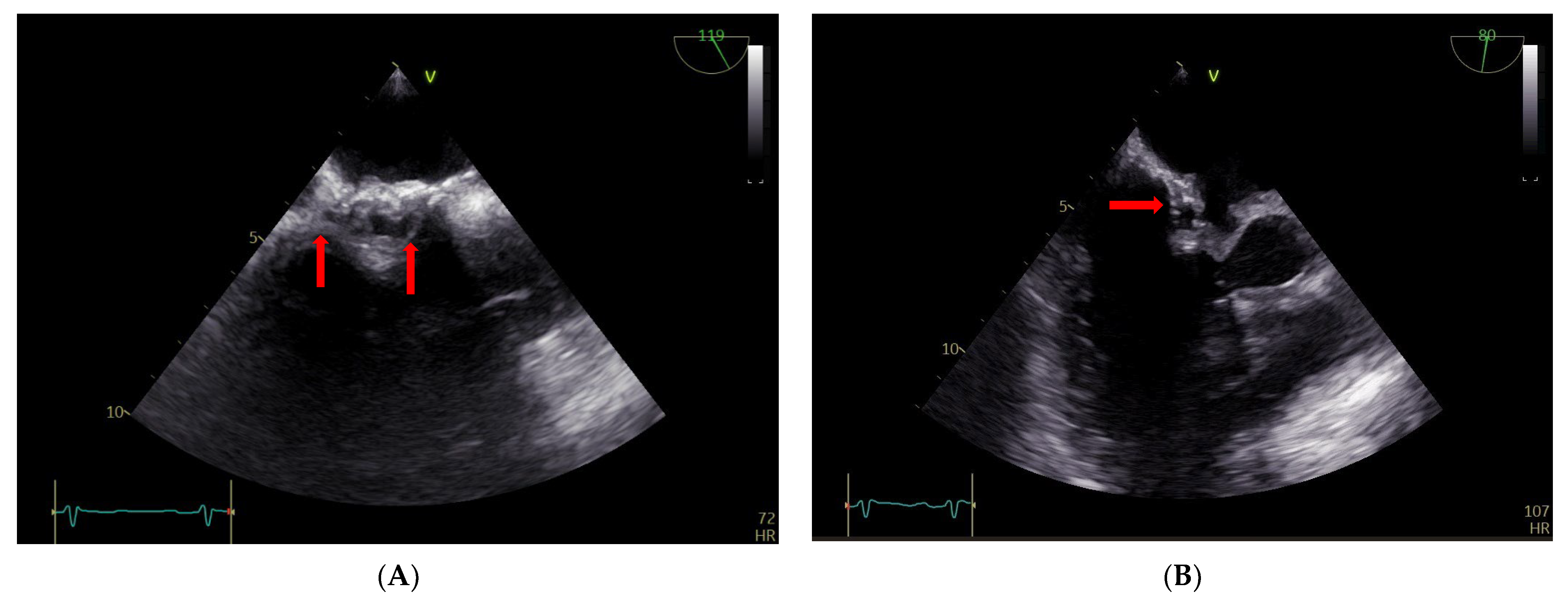 Diagnostics 13 00856 g004