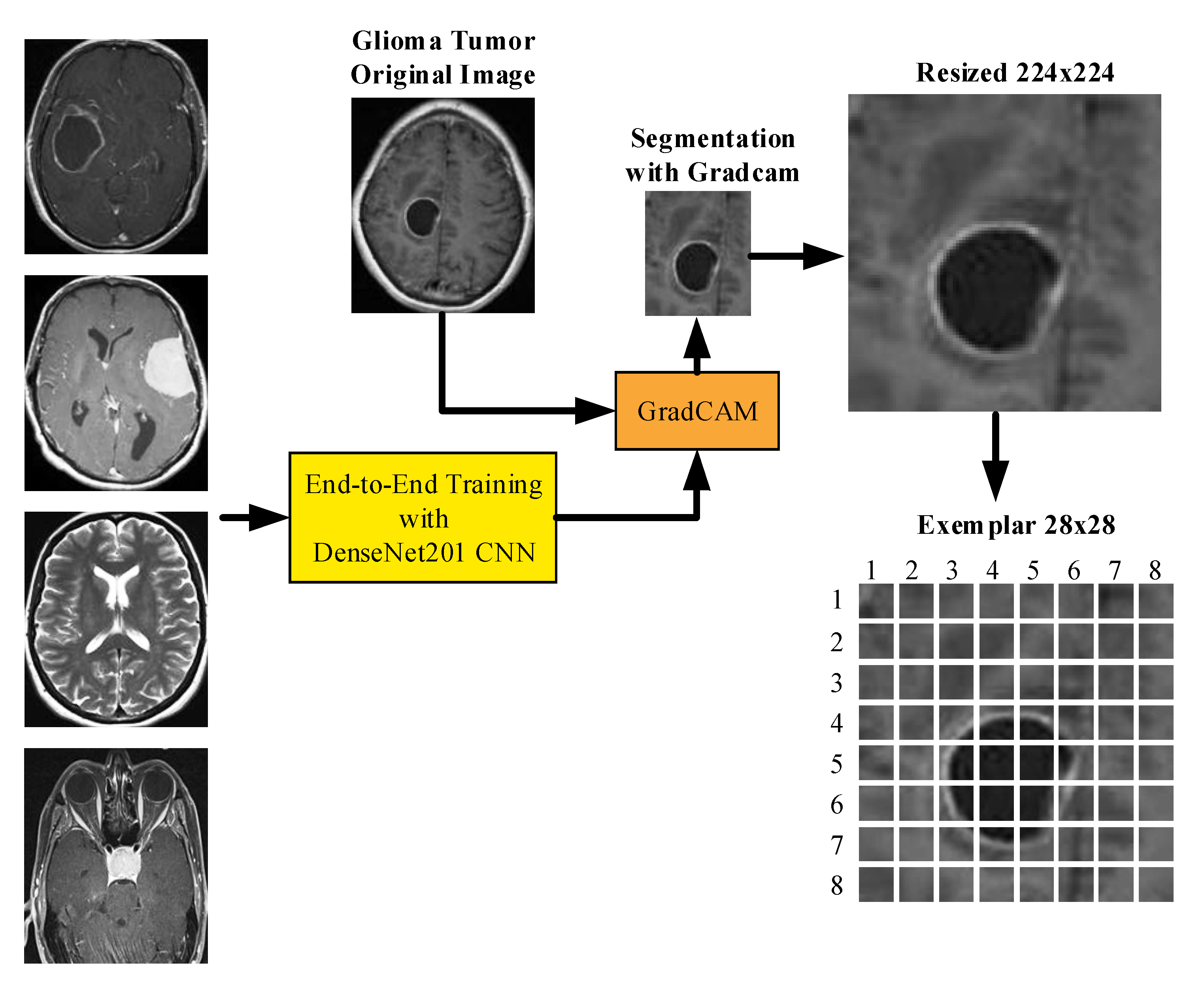 Attention Deep Feature Extraction from Brain MRIs in Explainable Mode ...