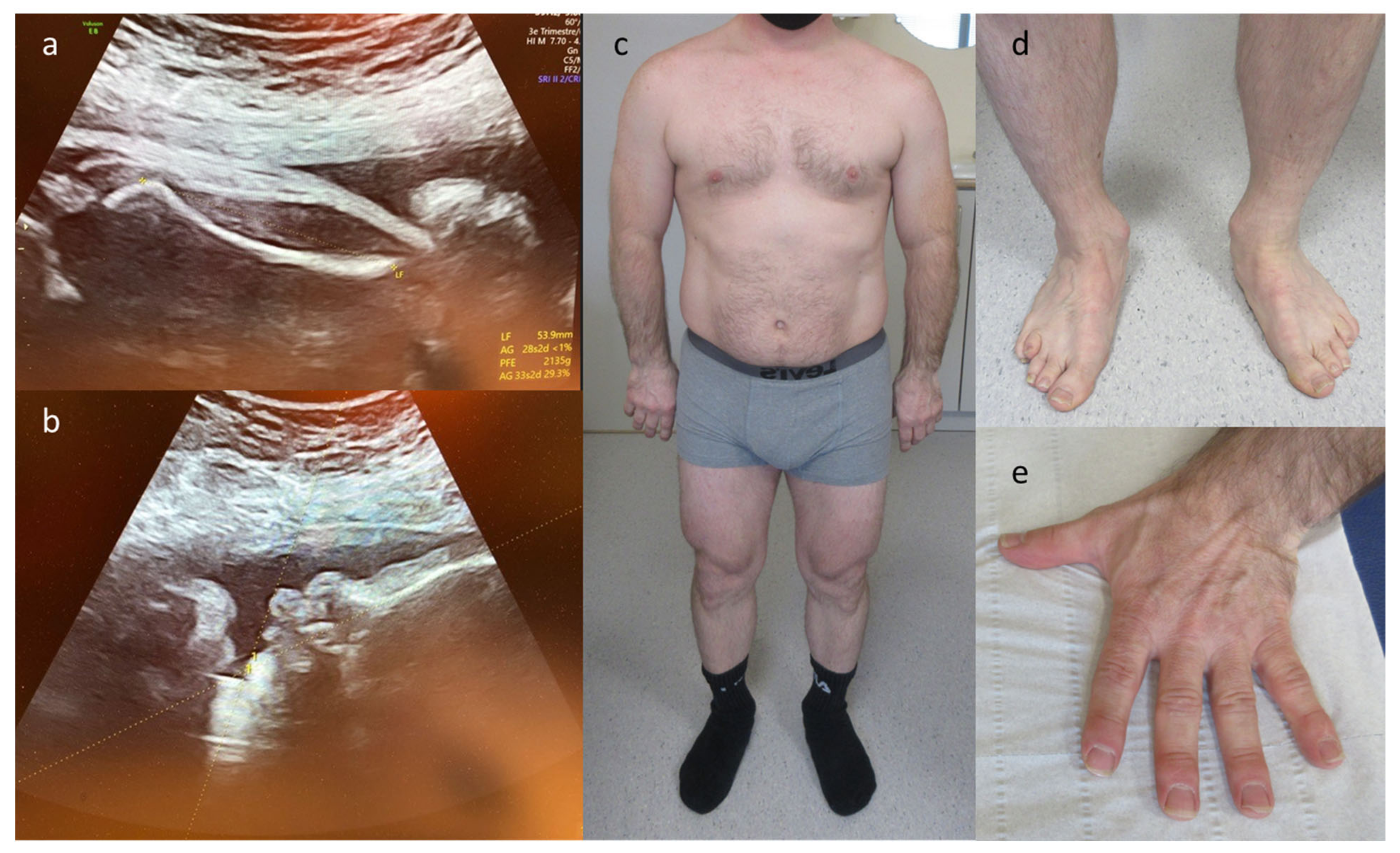 Diagnostics 13 00860 g003