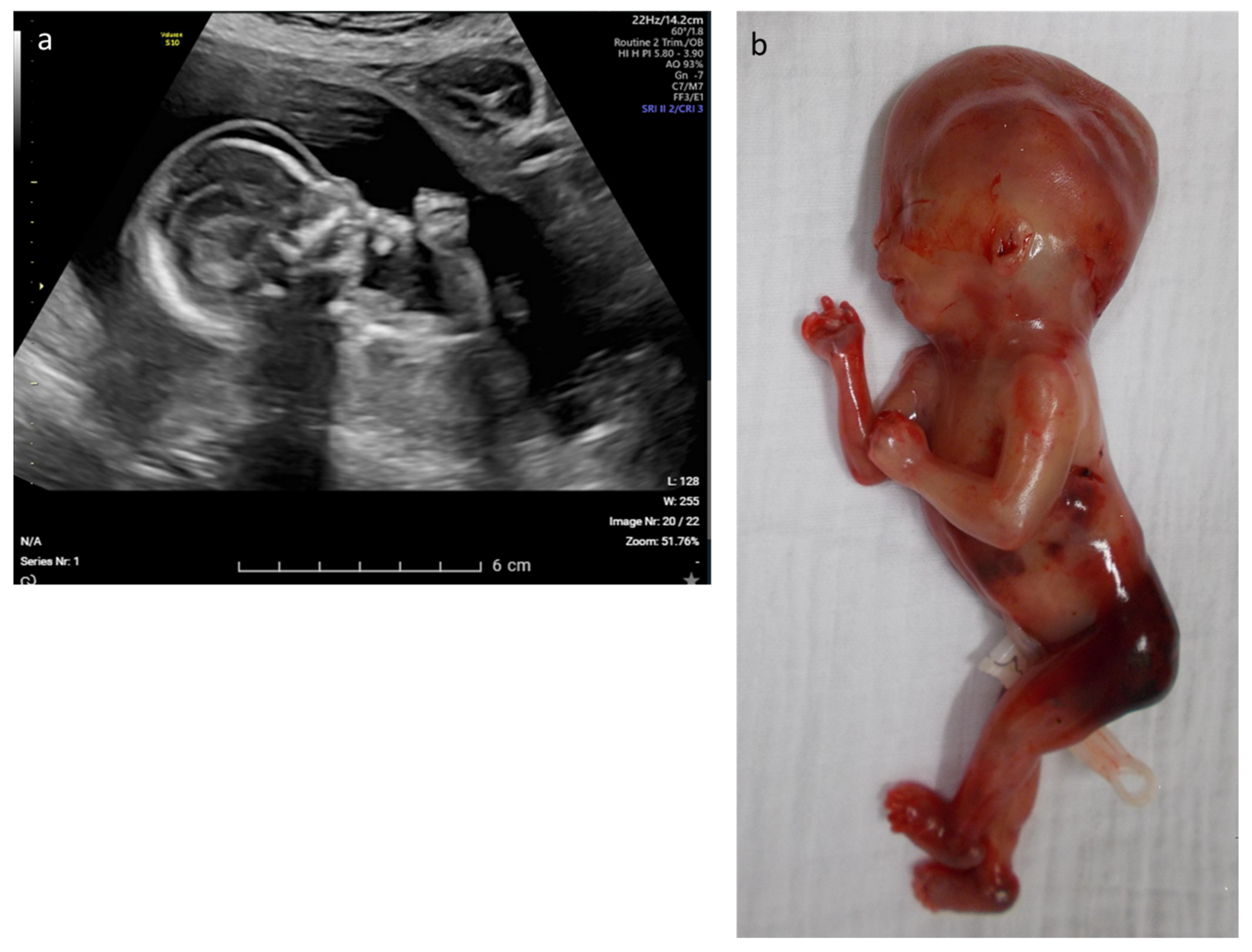 Diagnostics 13 00860 g004