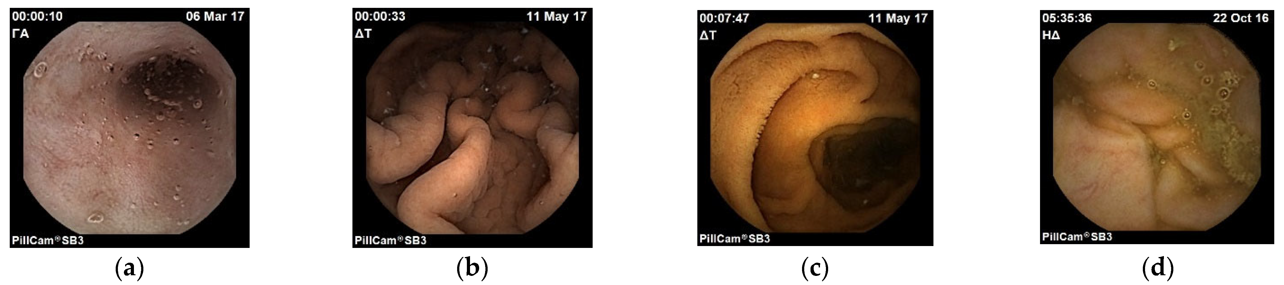 Diagnostics 13 00865 g002