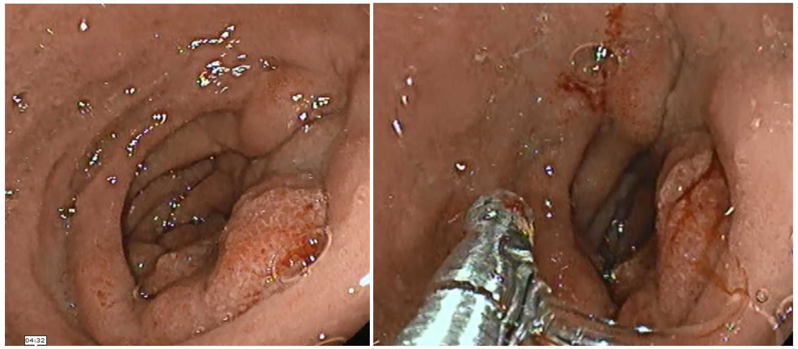 Diagnostics 13 00866 g001 Diagnostics 13 00866 g001