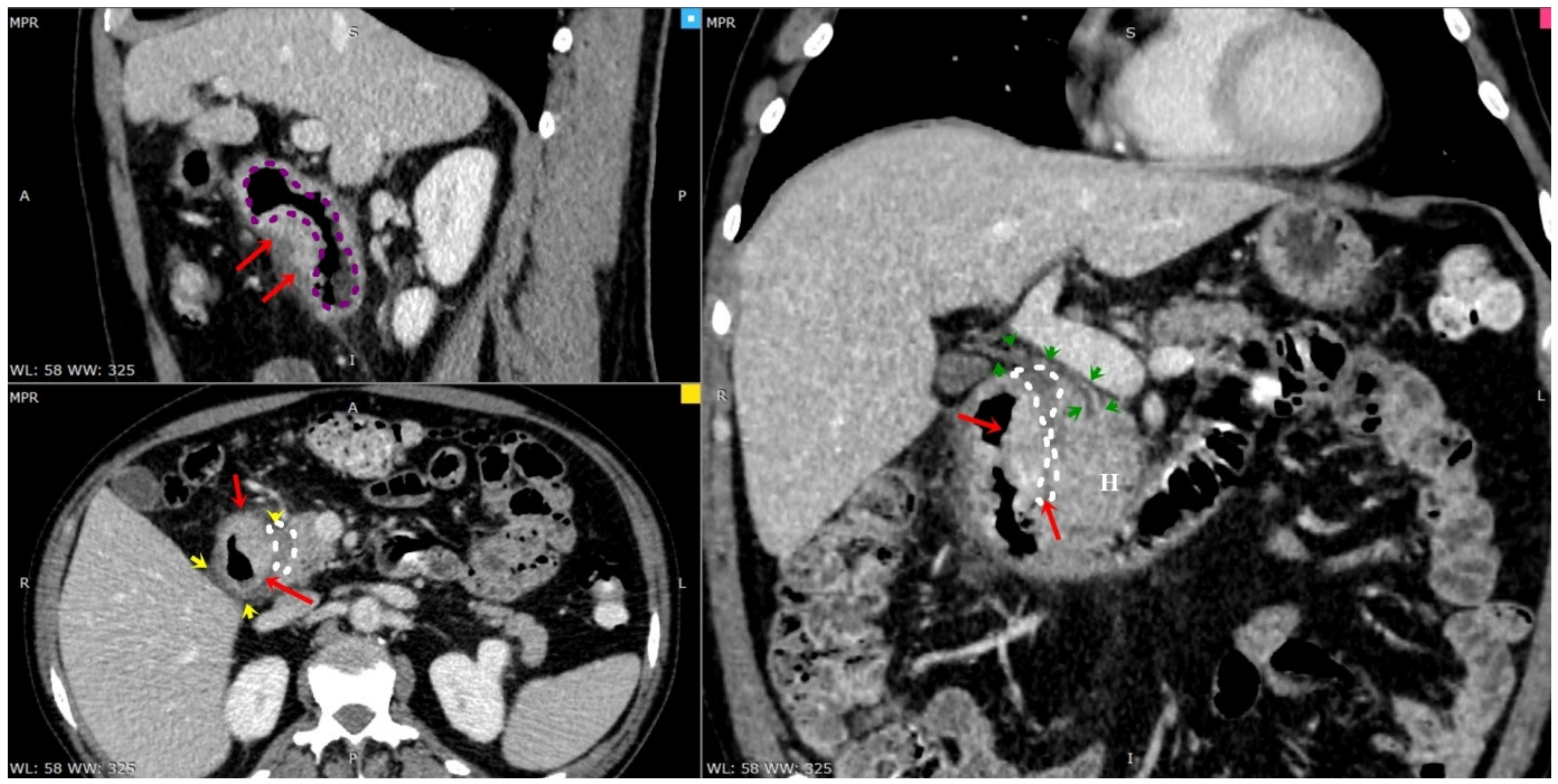 Diagnostics 13 00866 g003 Diagnostics 13 00866 g003